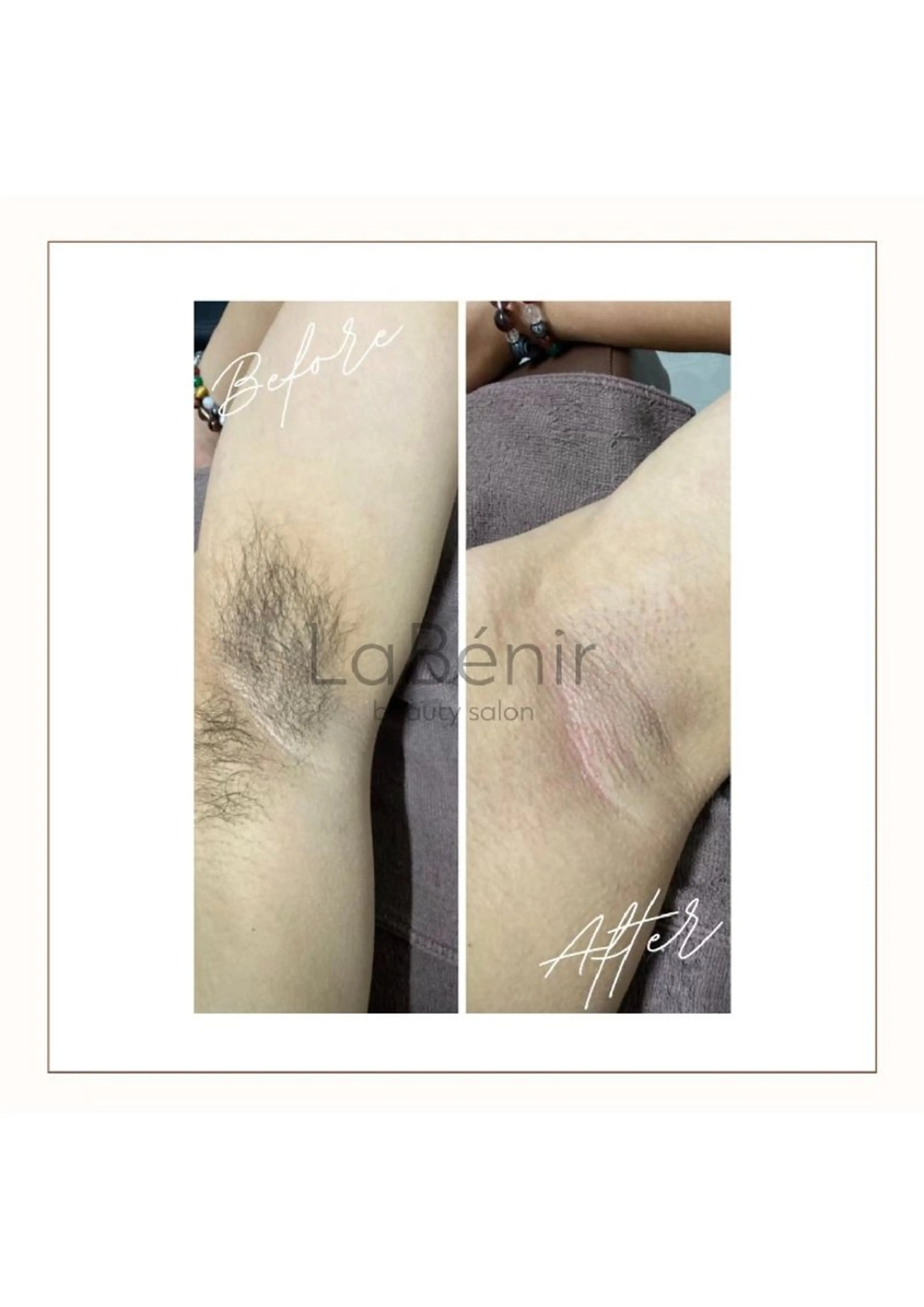 メンズ 脱毛/美肌【皮膚科看 護師経営】ラベニールのエステ・リラクイメージ