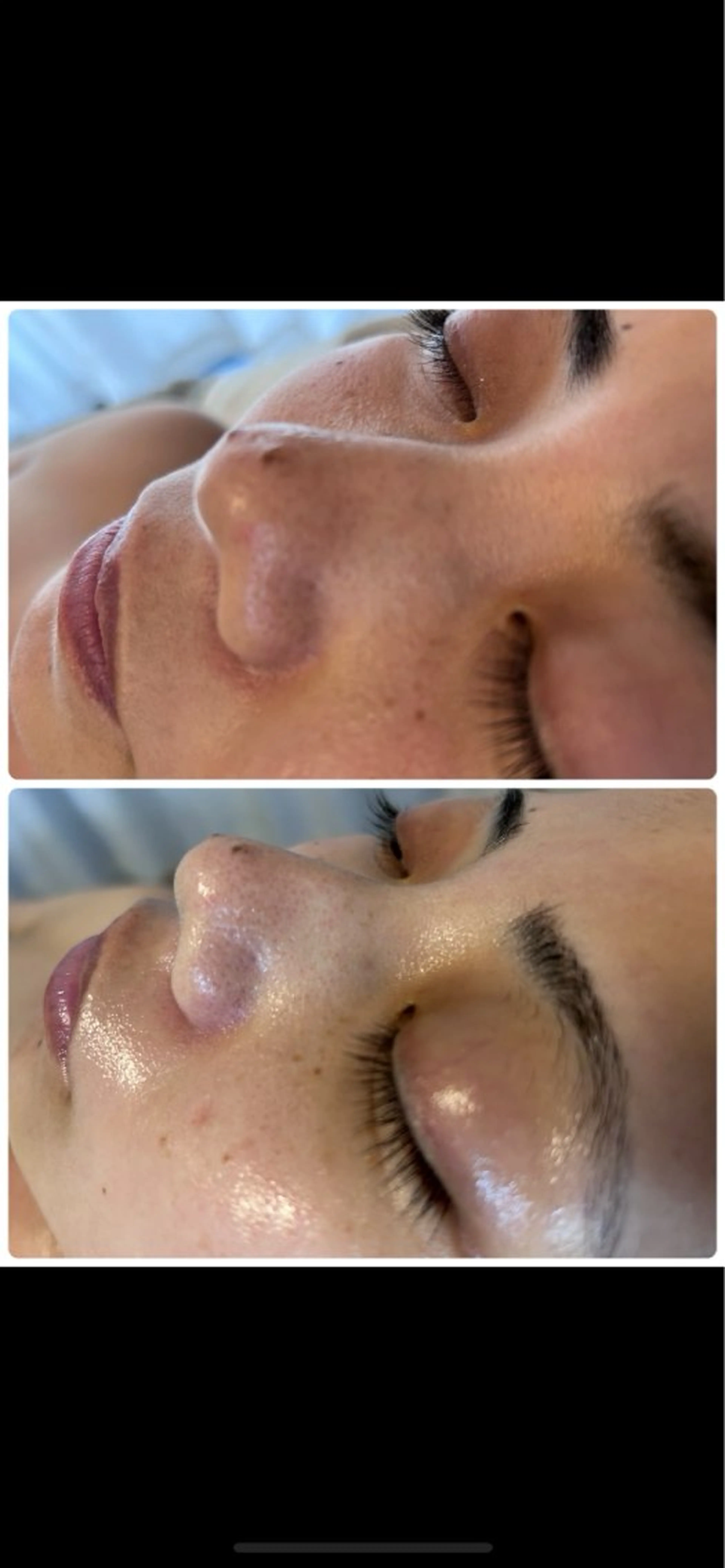 脱毛 Beauty salon Wish所属・脱毛🌈肌質改善🌈 Wishのエステ・リラクイメージ