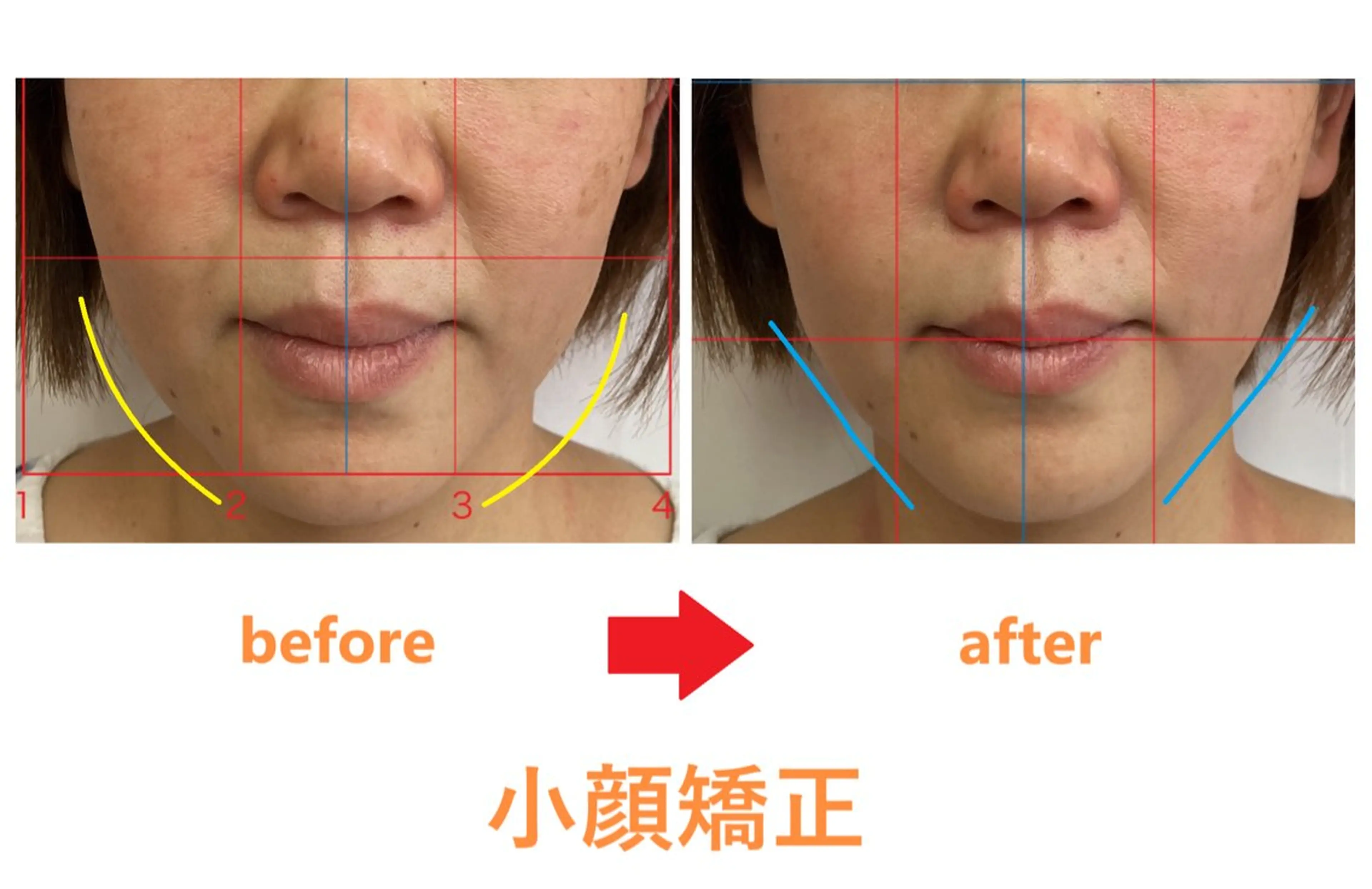 豊津BM整骨院所属・木田 明訓のエステ・リラクイメージ