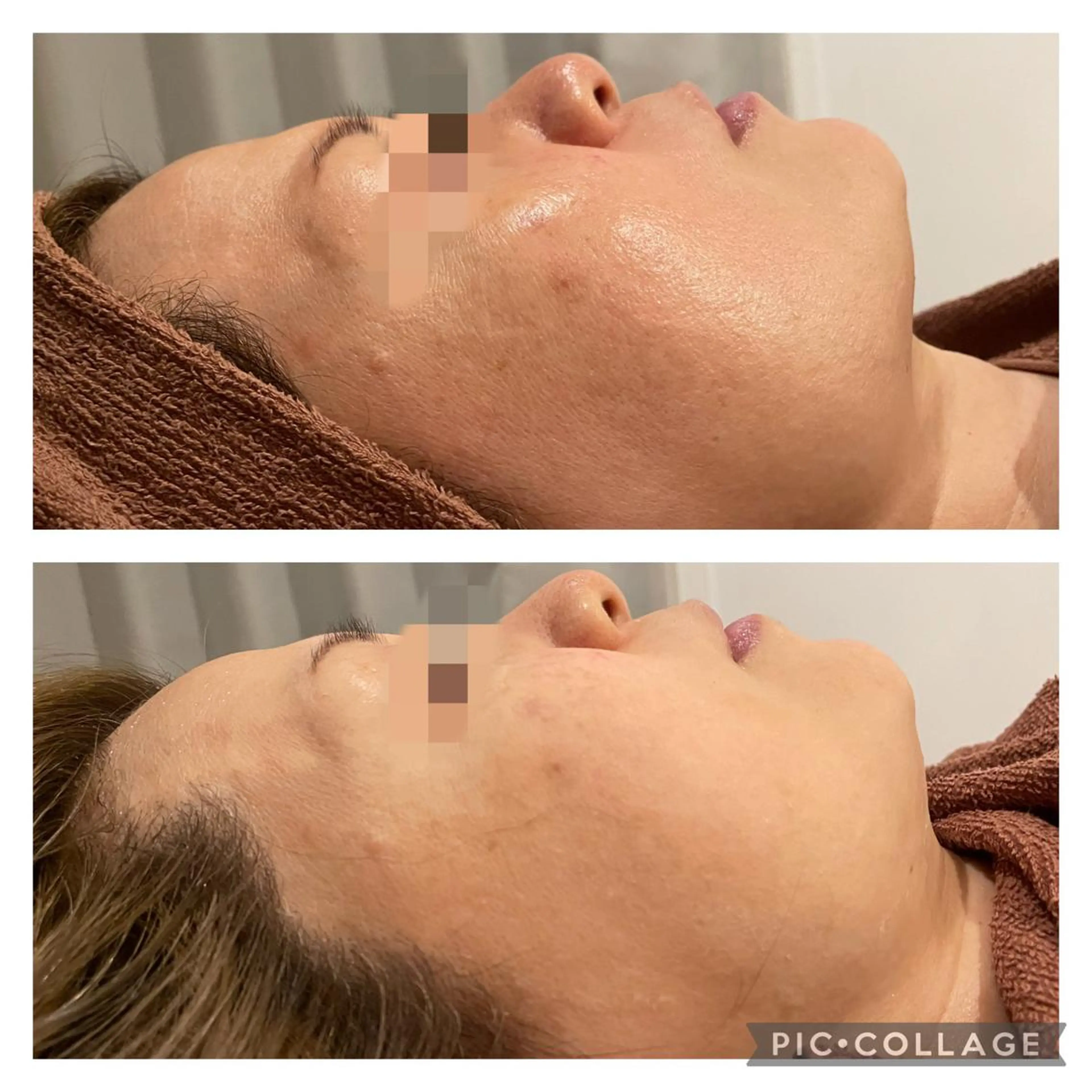 ロング カラー パーマ ヘアアレンジ メンズ キッズ ネイル マツエク・マツパ アイブロウ ニキビ特化型エステ 🍓最短で肌質改善のその他イメージ