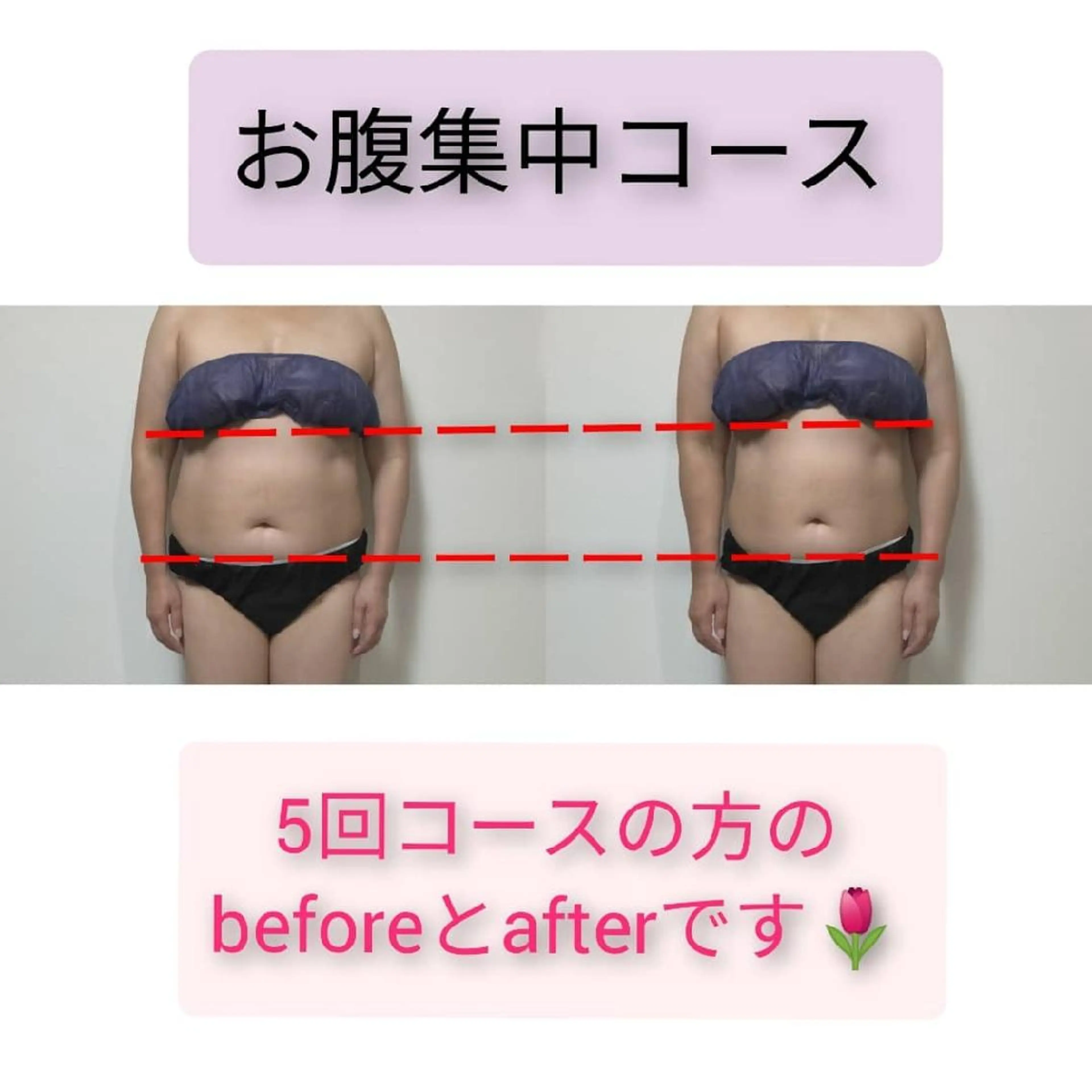 Alphaplus AYAMI のエステ・リラクイメージ