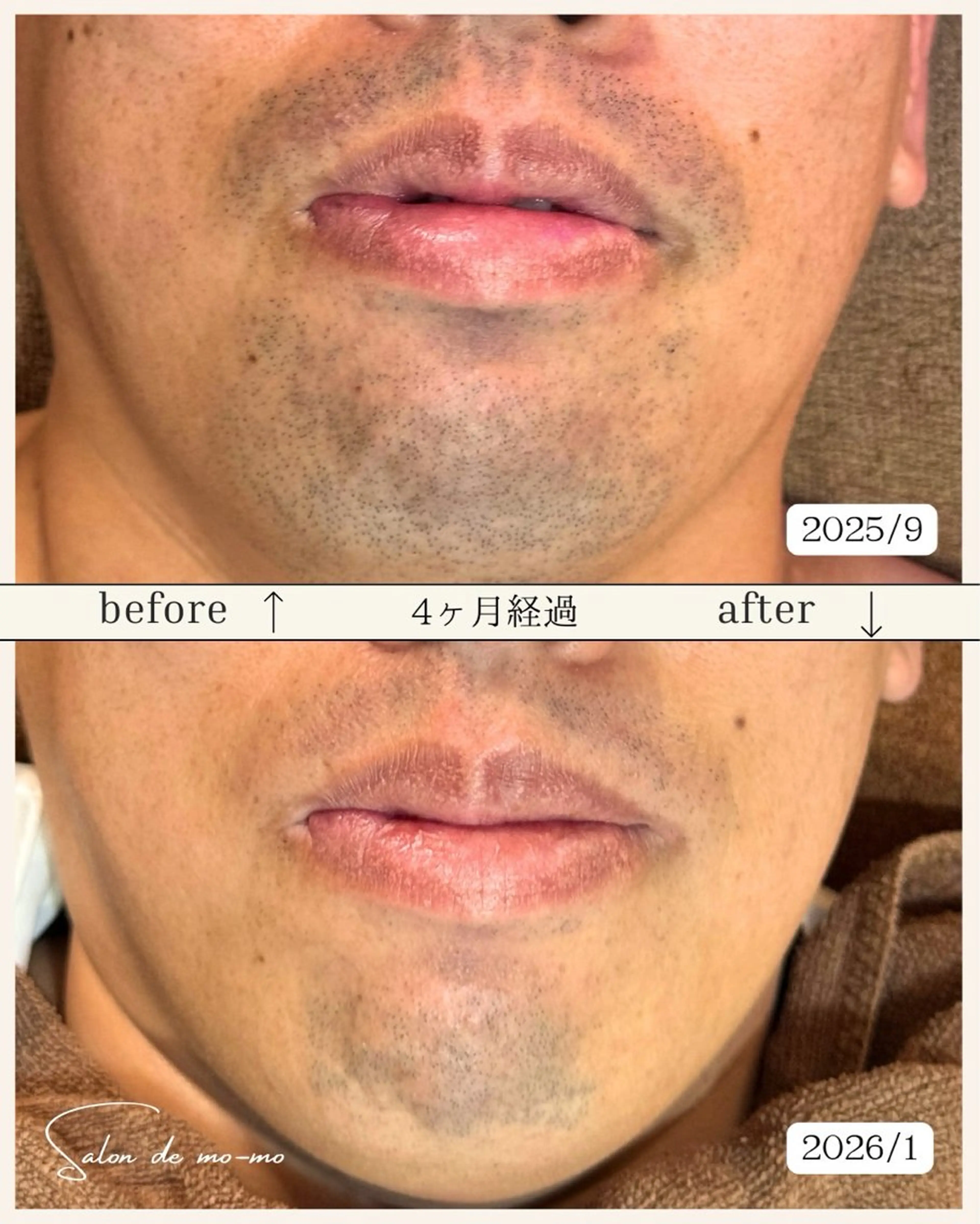 吉沢 晴のエステ・リラクイメージ