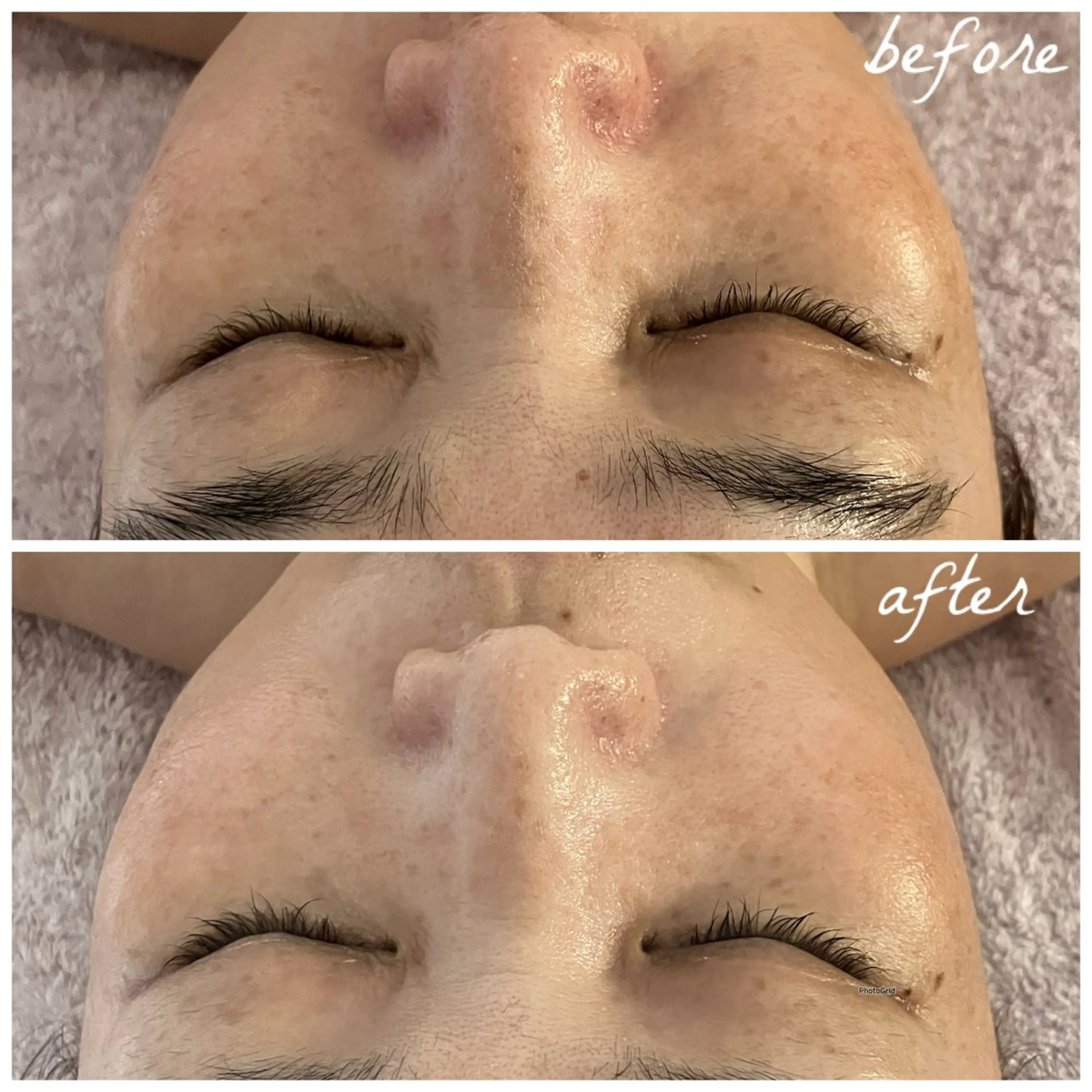 メンズ エステ メナード岐阜茜部 杉浦のエステ・リラクイメージ