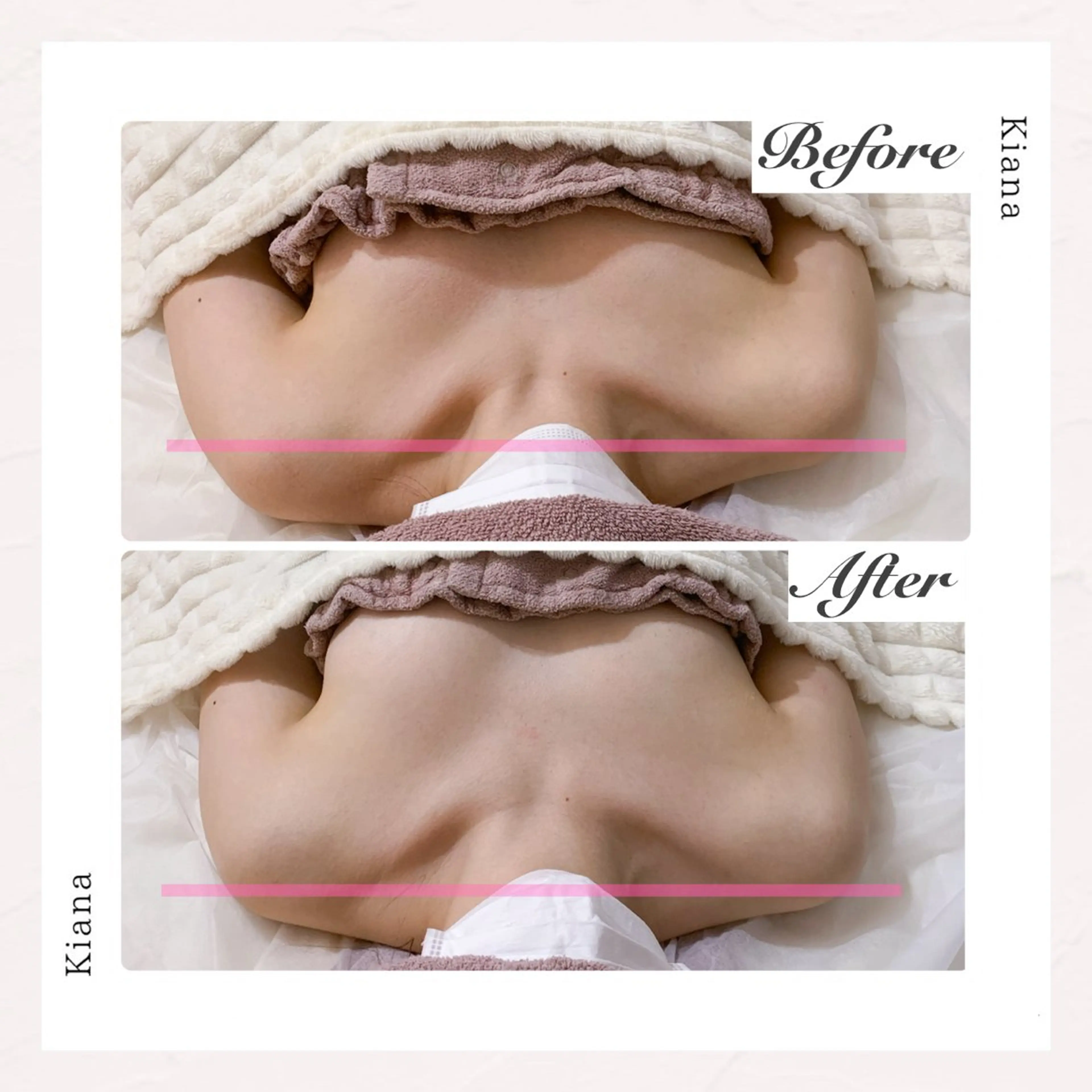 バスト専門Kiana 風のエステ・リラクイメージ