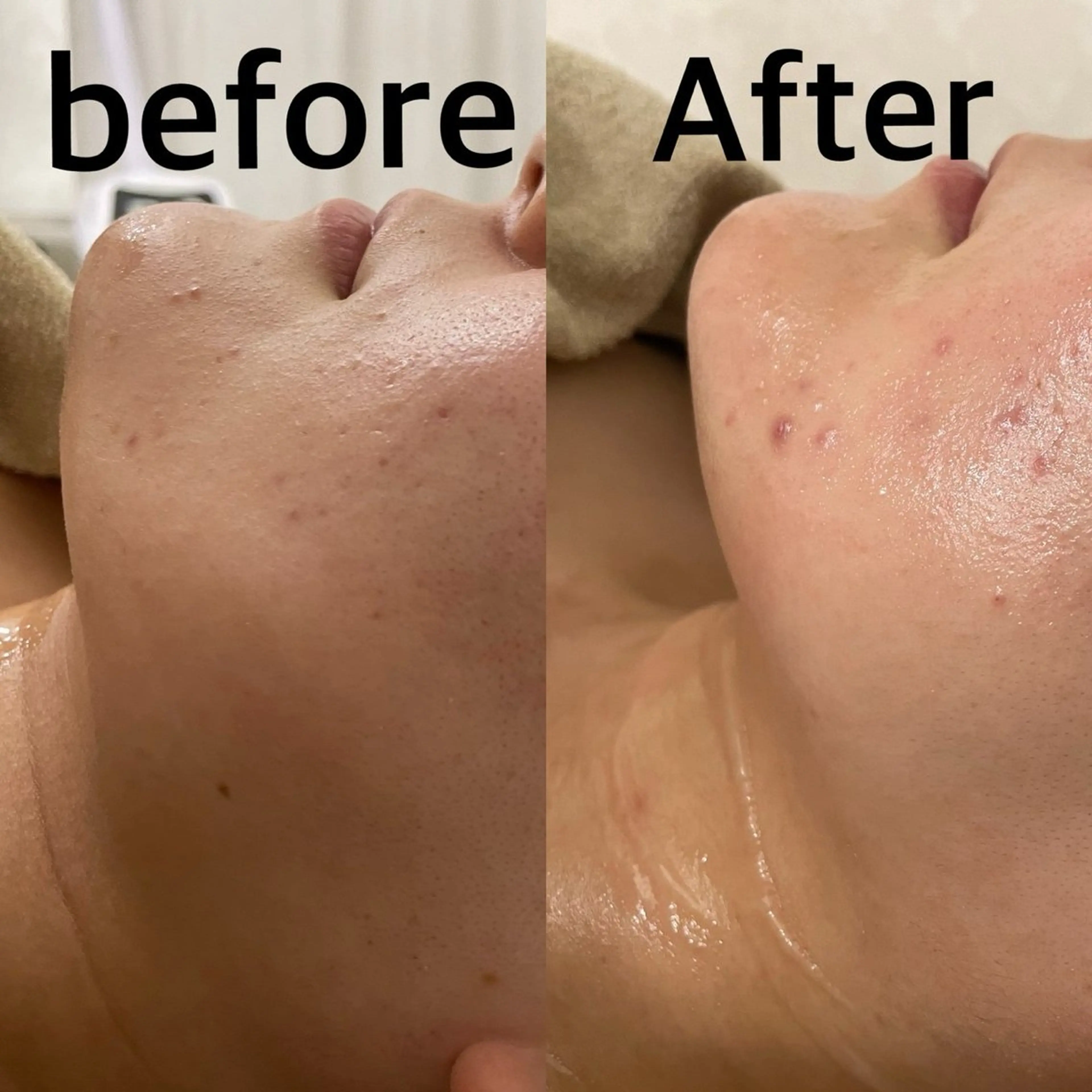 エステ フェイシャルサロン CHIARA 荒田のエステ・リラクイメージ