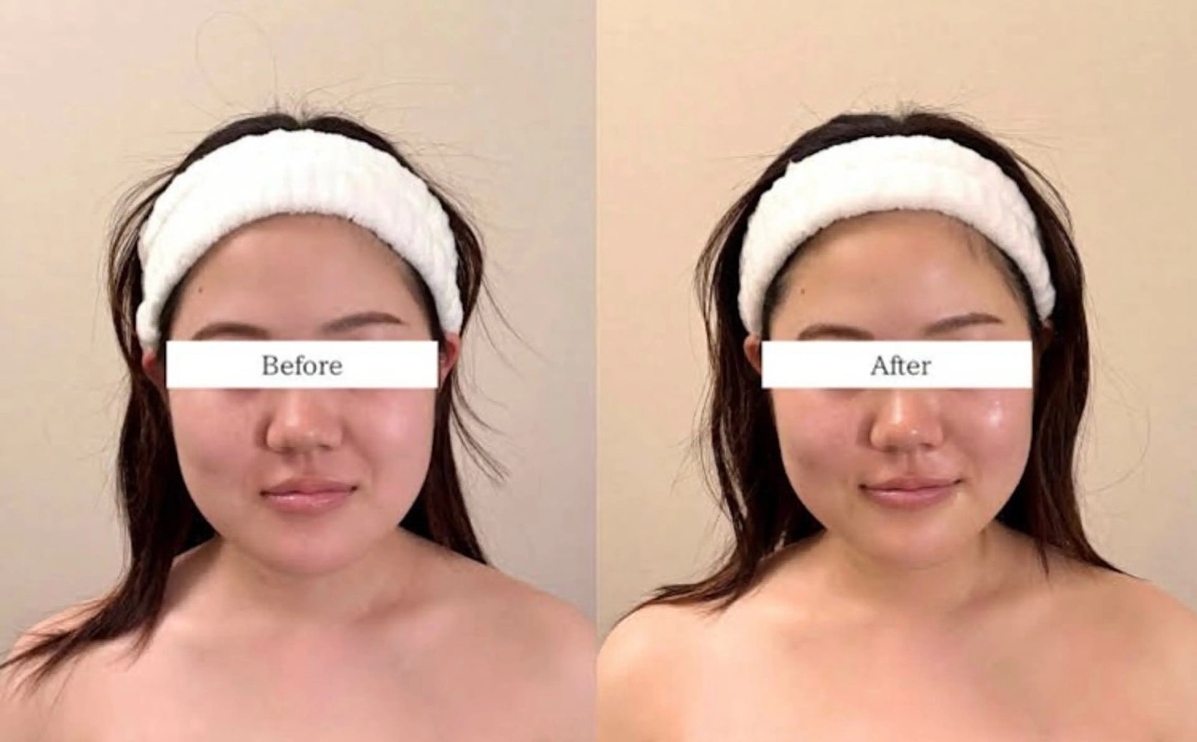 Black Stone所属・Black Stoneのエステ・リラクイメージ