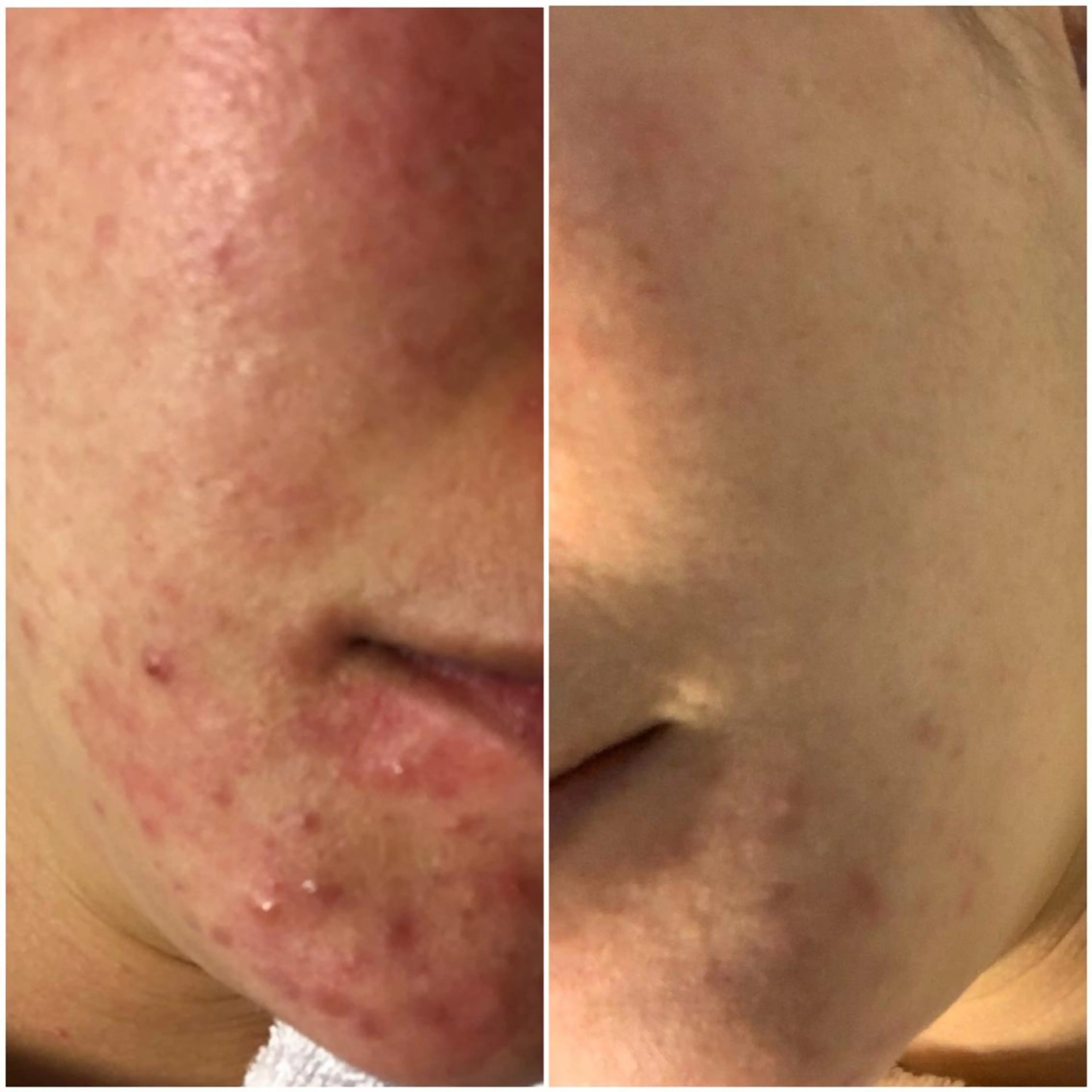 aliaハイフ&水光ジェットサロン所属・aliaハーブ水光店 エステティシャン募集のエステ・リラクイメージ