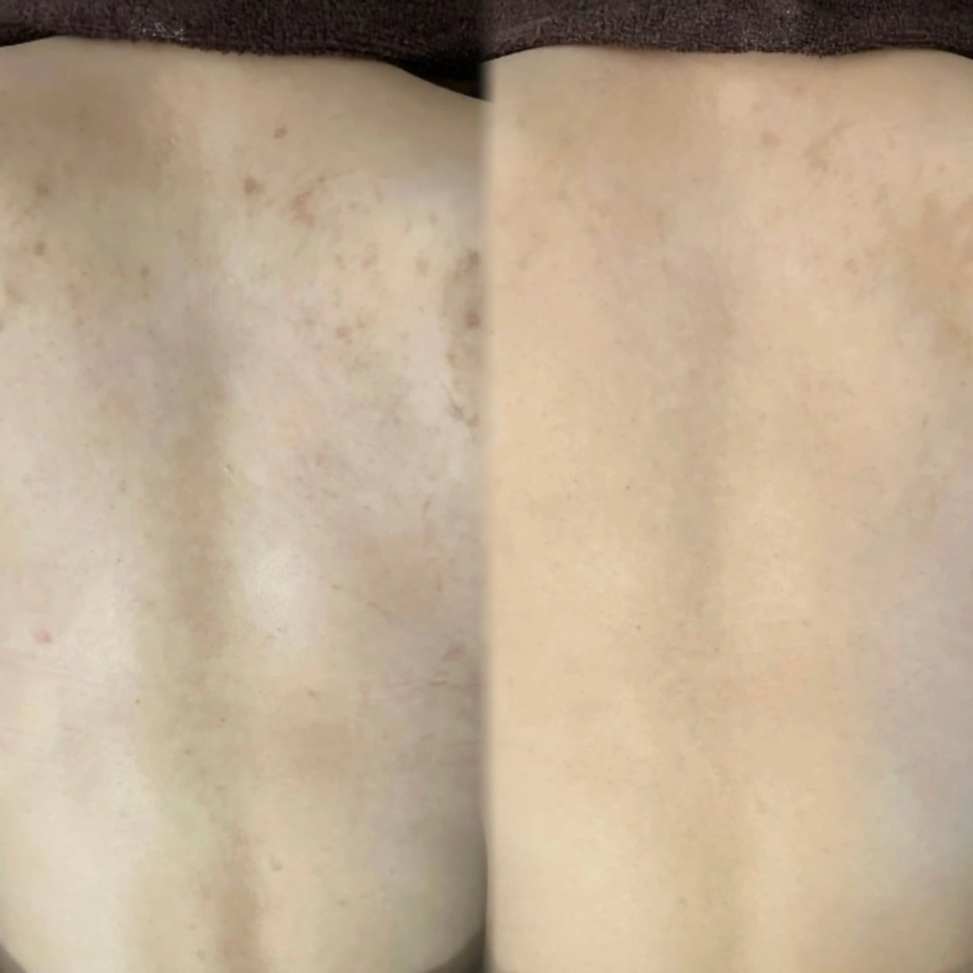 エステ salon MUSUBUのエステ・リラクイメージ