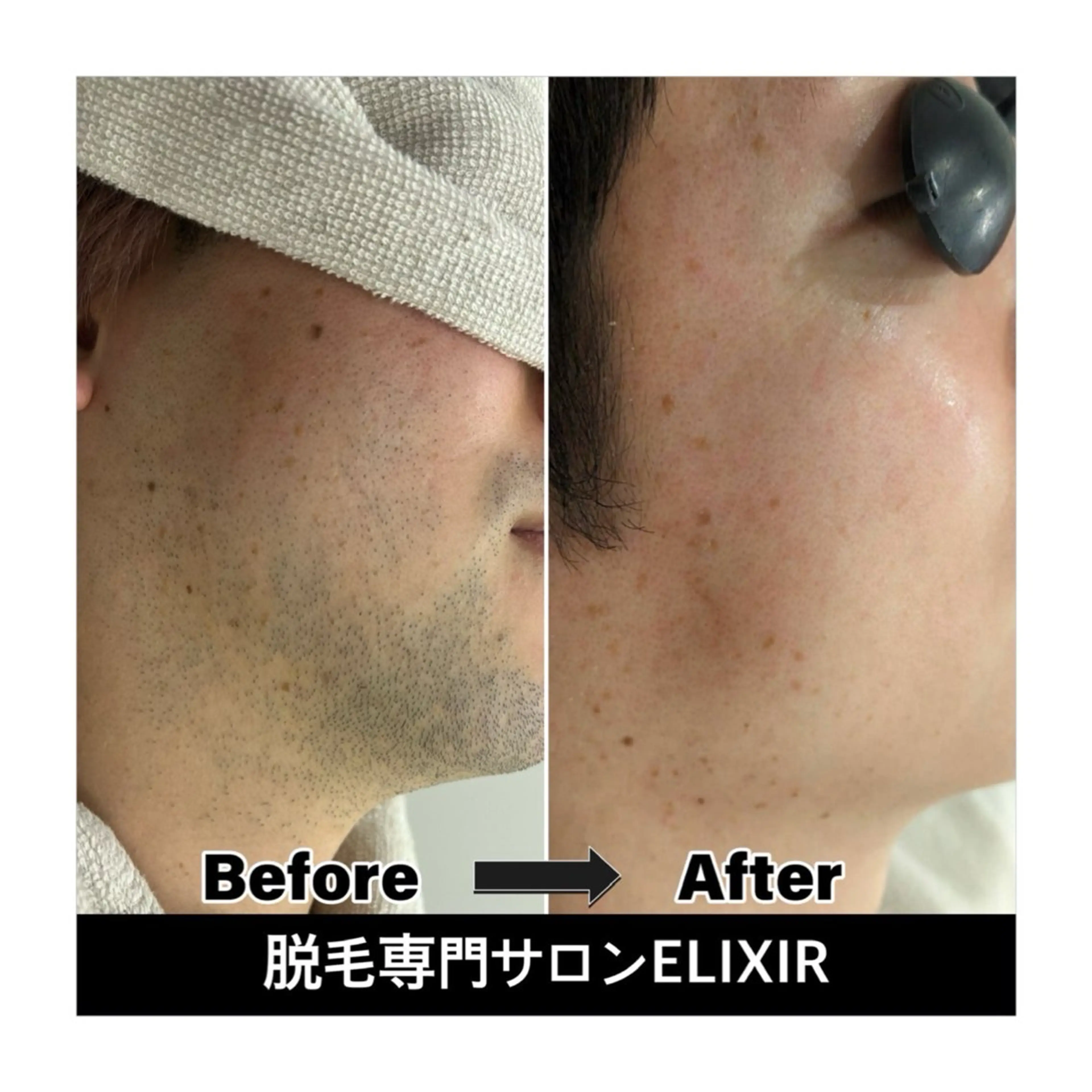 脱毛専門サロンElixir加須店所属・脱毛専門サロン Elixir　加須店のエステ・リラクイメージ