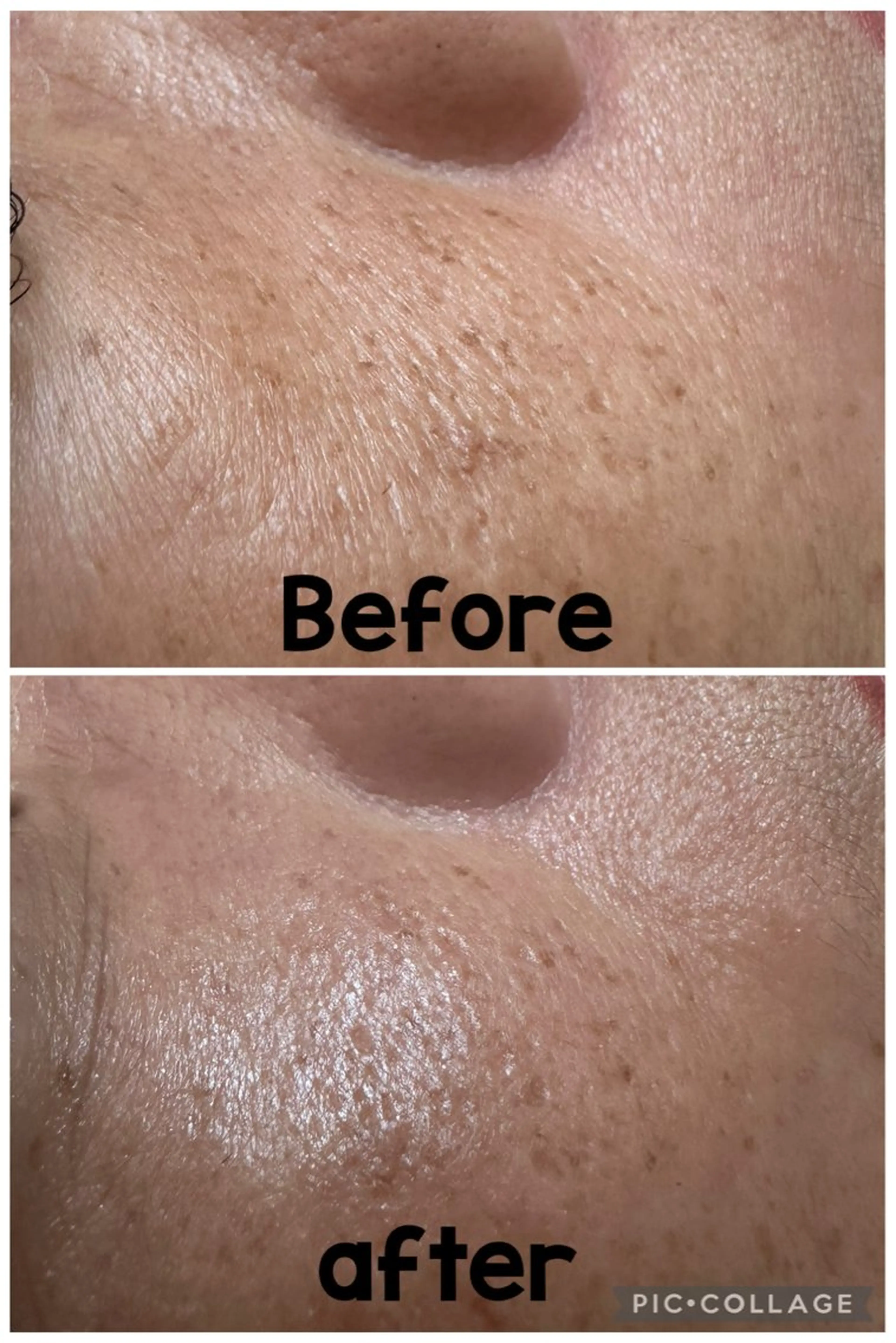 EPIL yuiのエステ・リラクイメージ