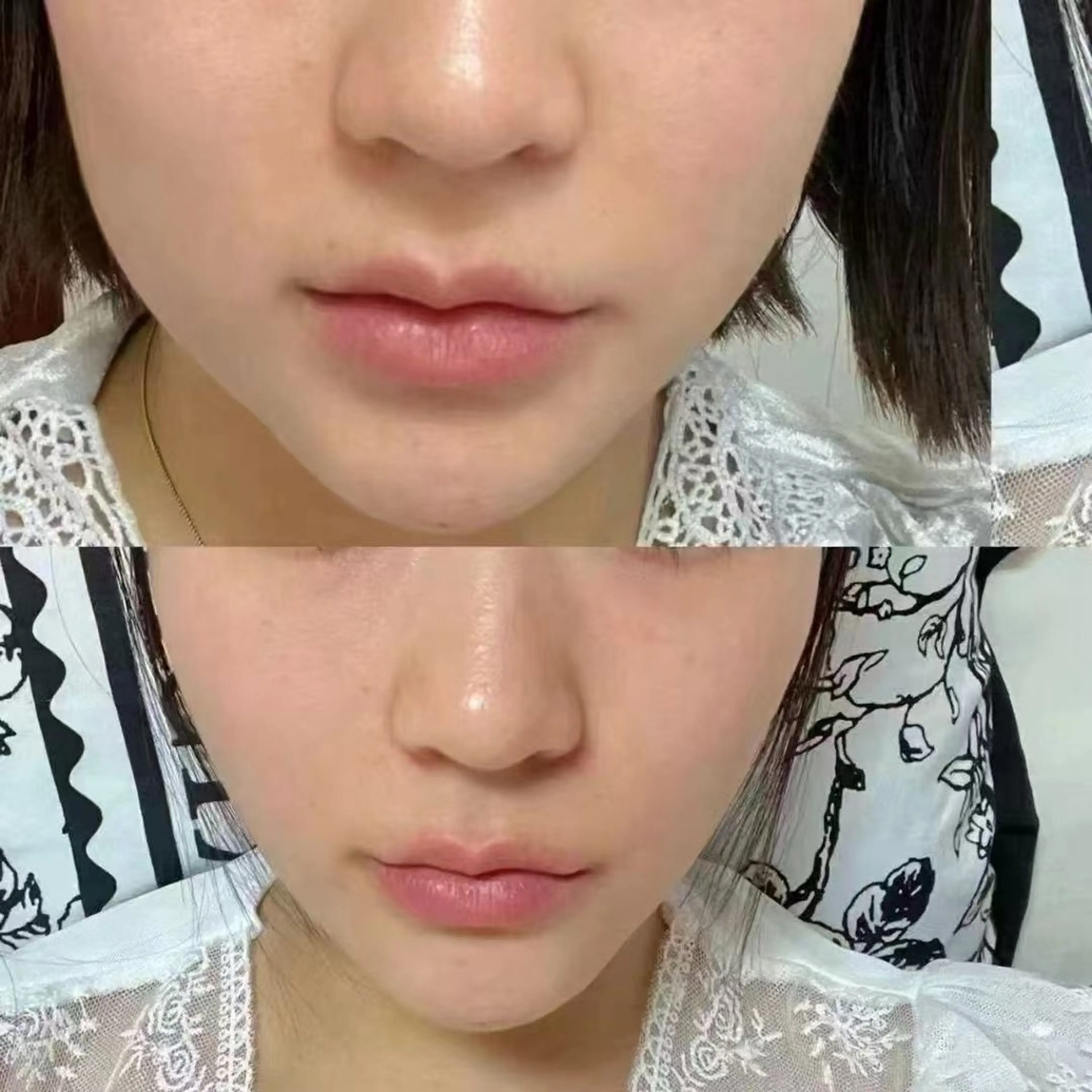 マツエク・マツパ エステ aliaハイフ&水光ジェットサロン所属・aliaハーブ水光店 エステティシャン募集のエステ・リラクイメージ