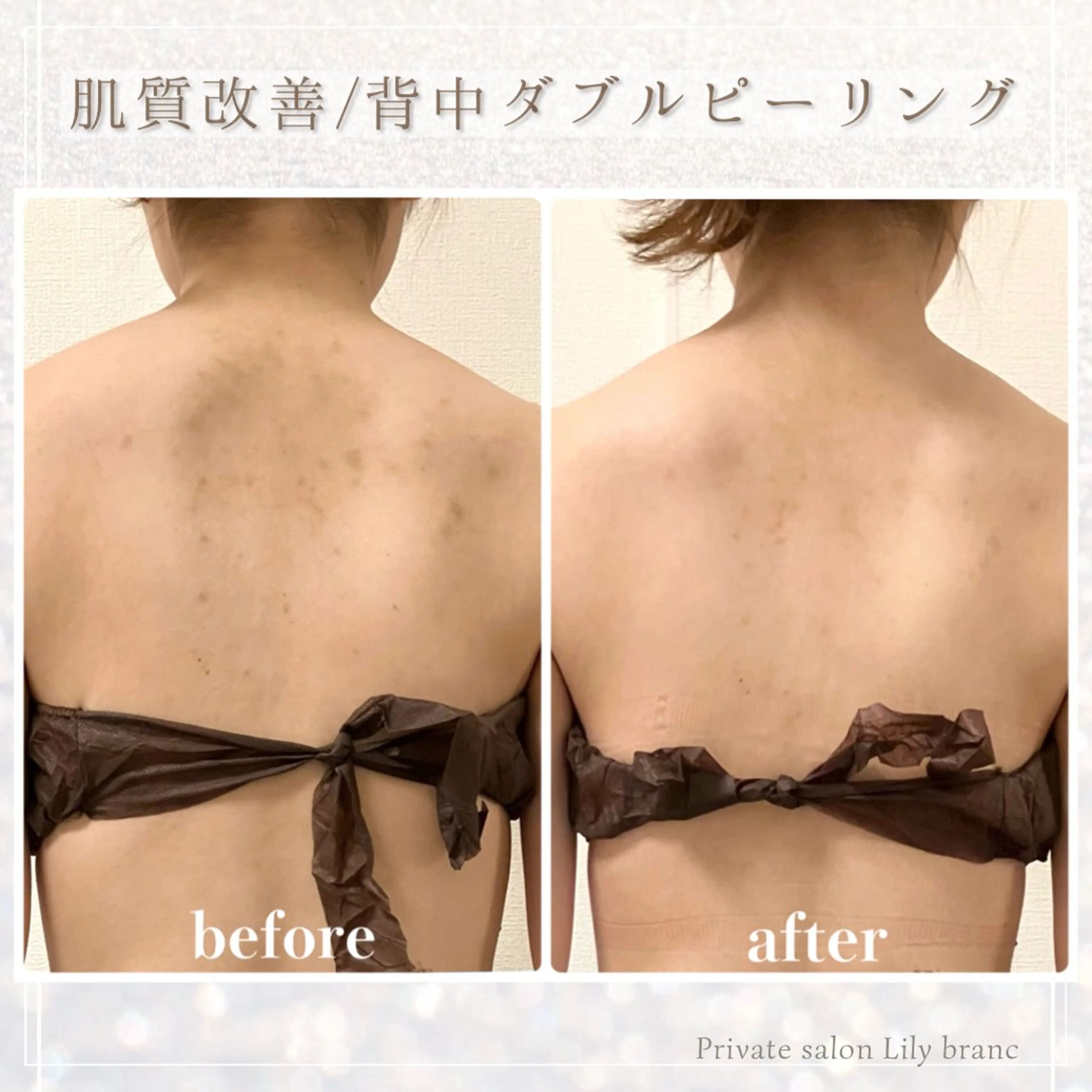 その他 Lily branc 痩身/小顔/肌質改善のエステ・リラクイメージ