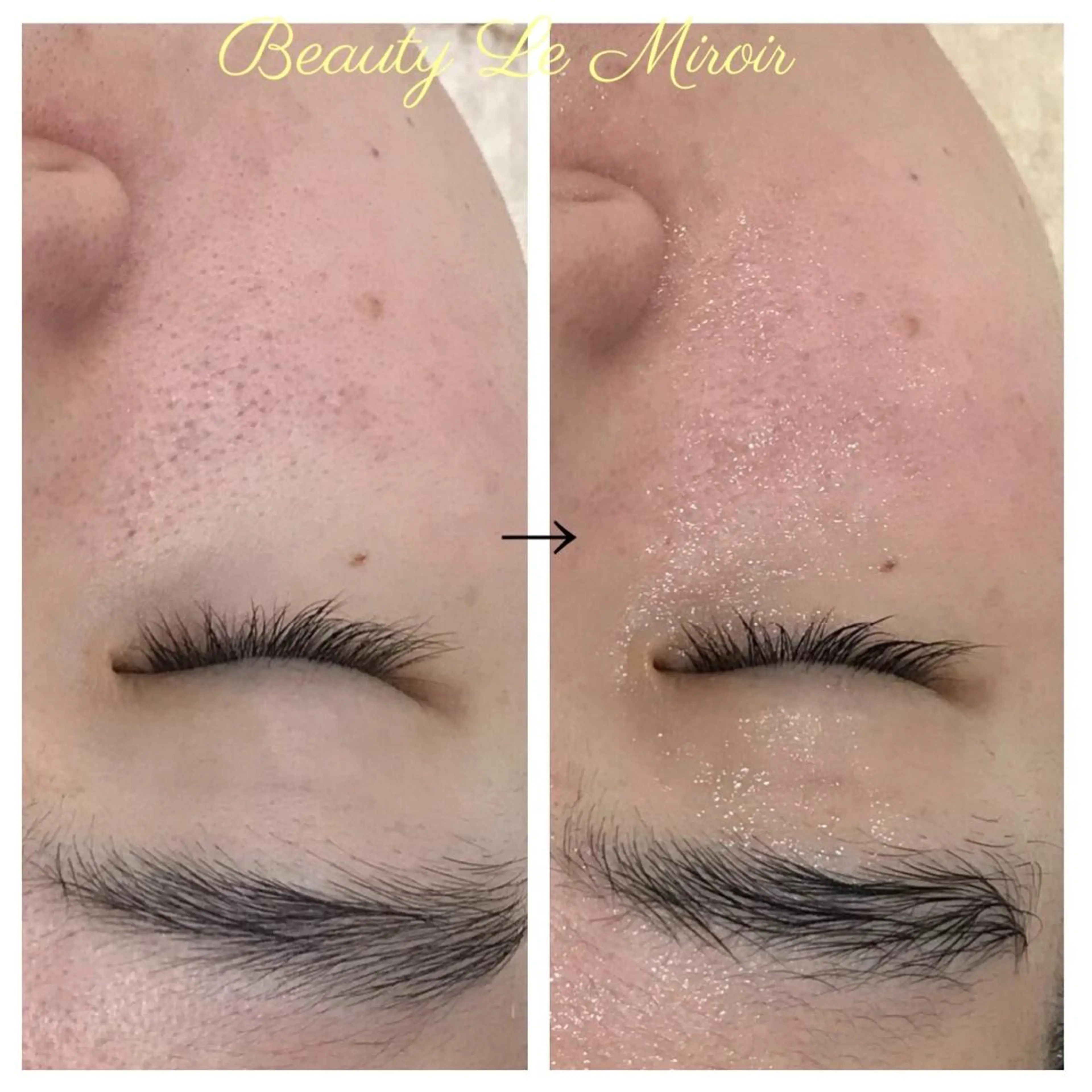 ビューティー ミロワールのエステ・リラクイメージ