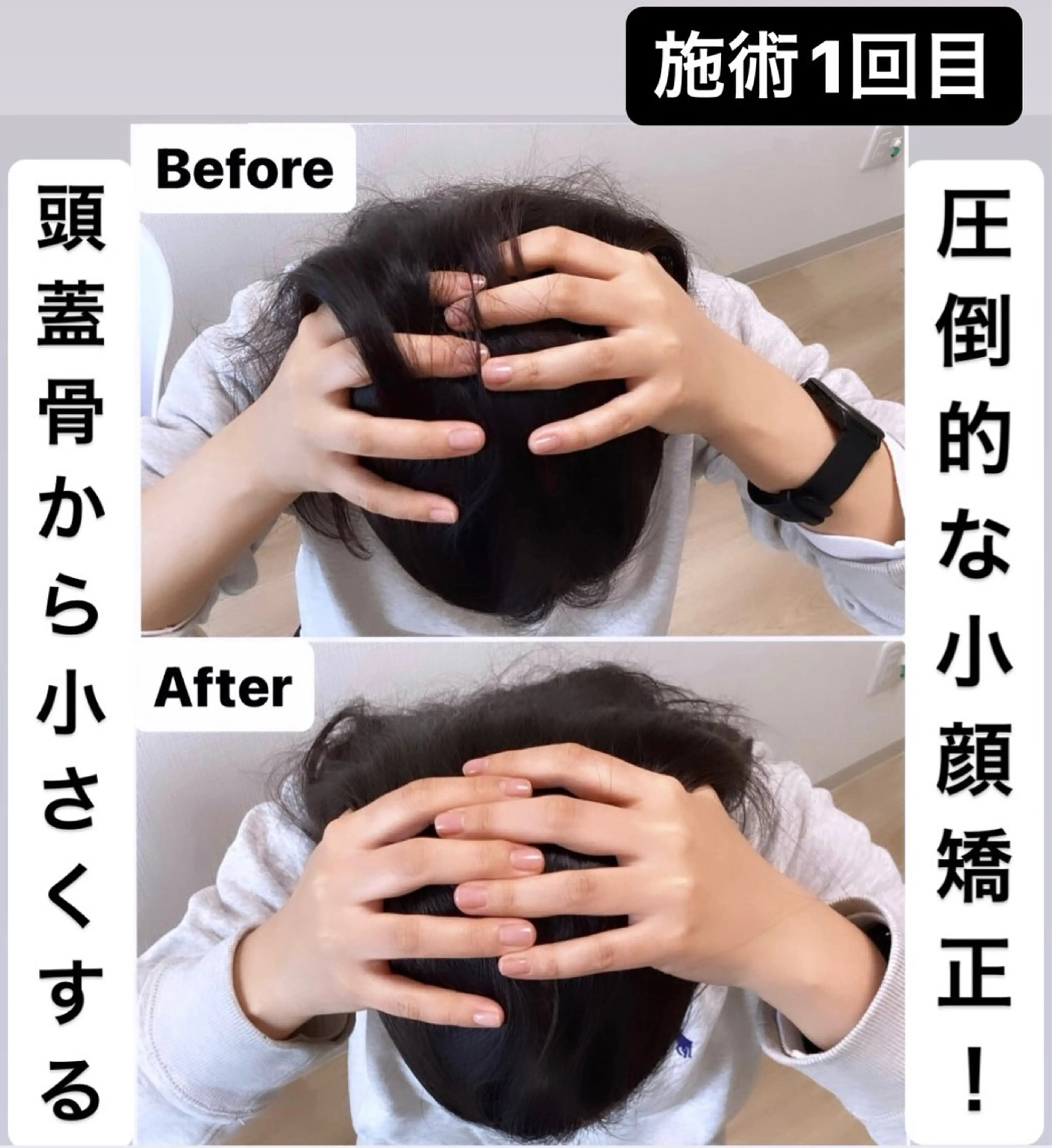 頭蓋骨から小さくする小顔&ヘッドスパ専門店 CANAEL所属・頭蓋骨から小さくする 小顔&ヘッドスパ専門のエステ・リラクイメージ