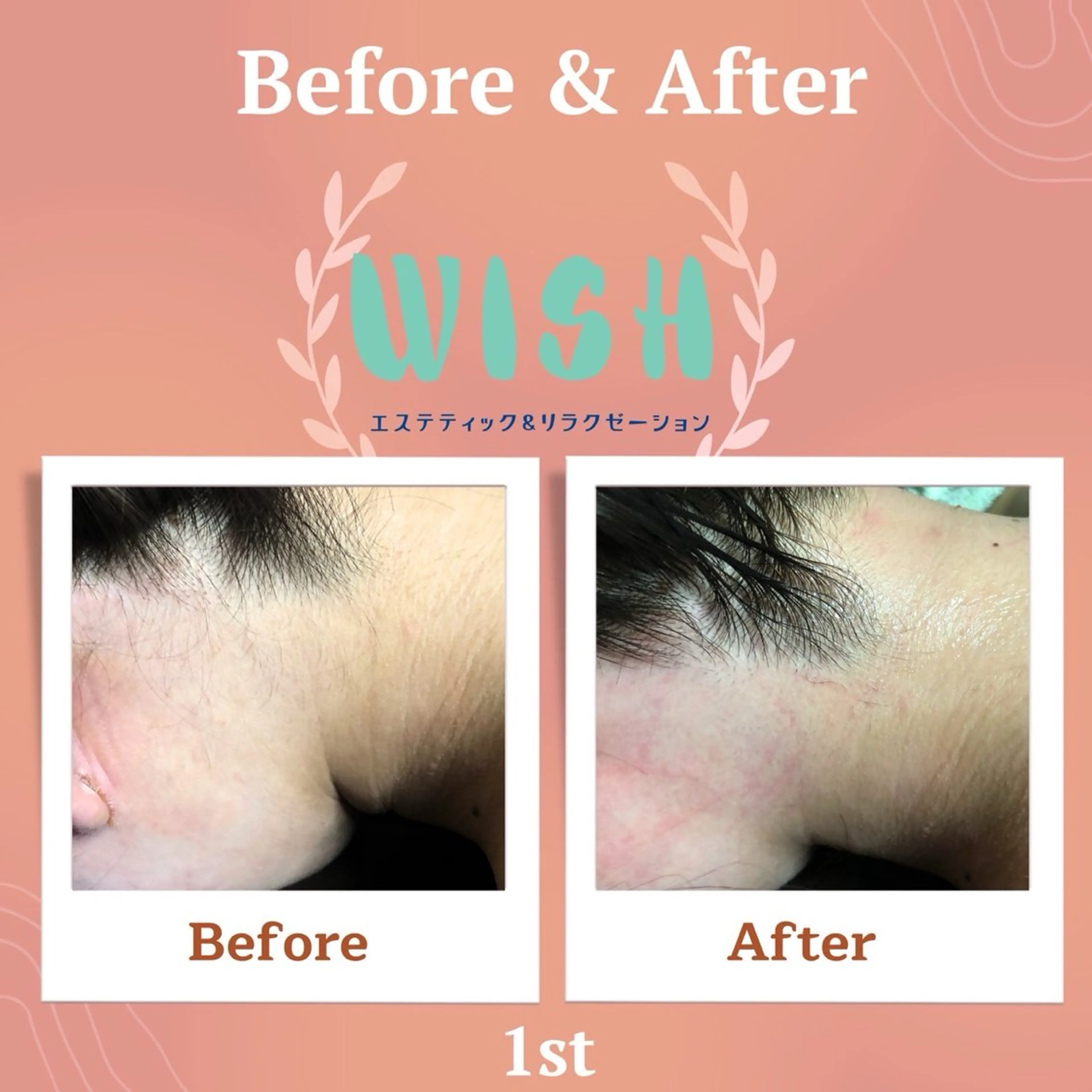 WISH 美肌脱毛のプロ！須藤のエステ・リラクイメージ