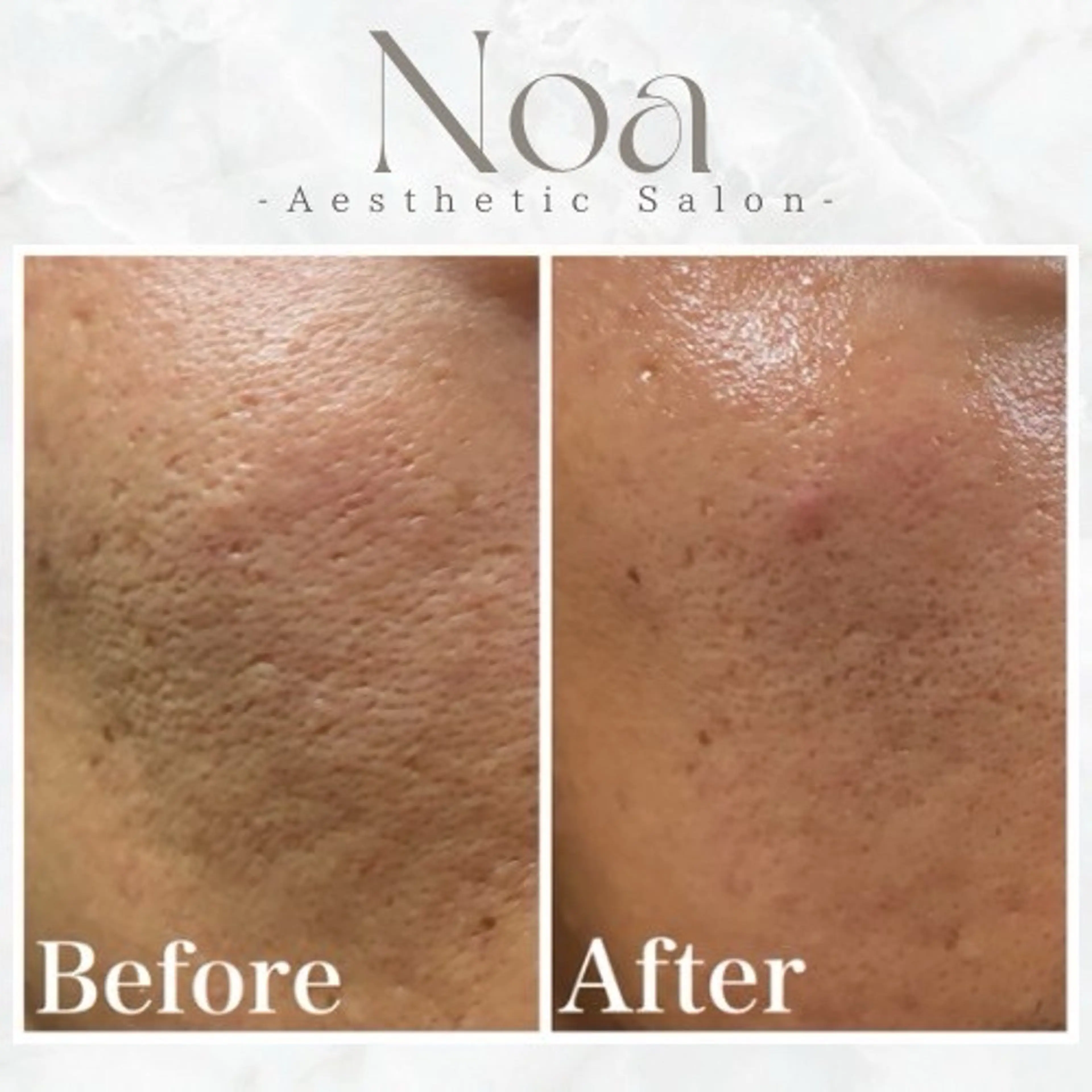 エステサロンNoa所属・肌質改善サロン Noaのエステ・リラクイメージ