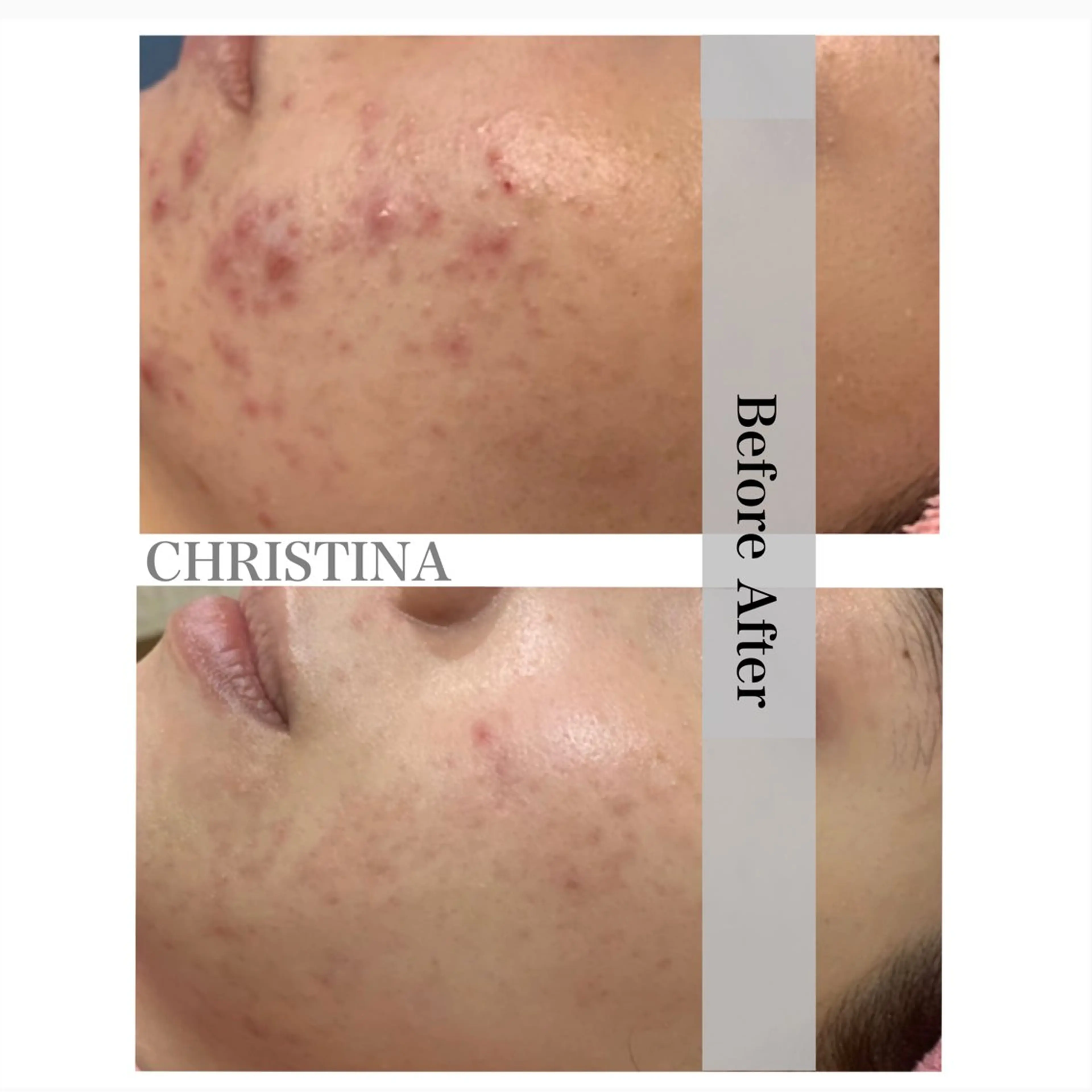 エステ矢野 ジョアアンジェ心斎橋のエステ・リラクイメージ