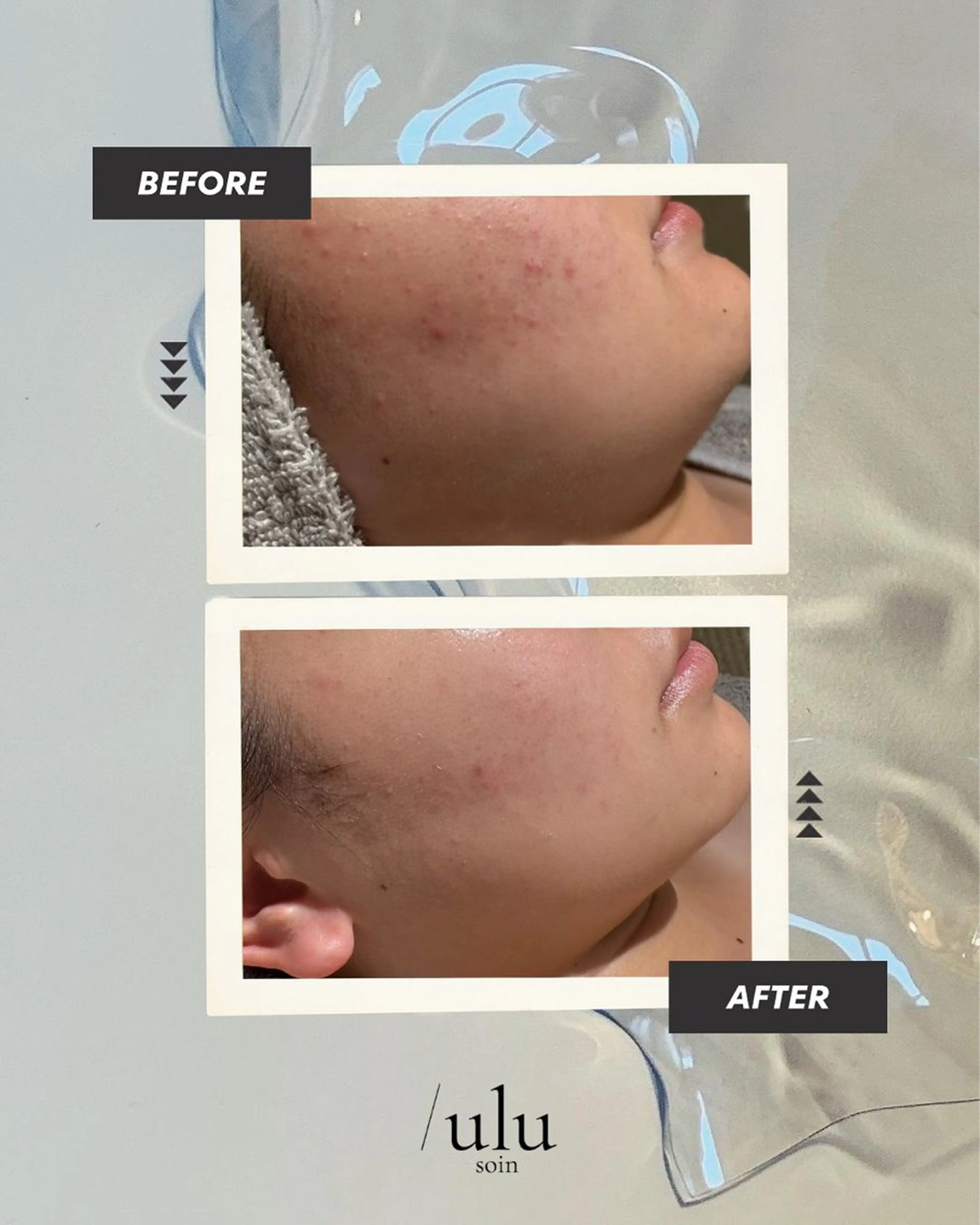 エステ /ulu  soin所属・太田 玲奈のエステ・リラクイメージ