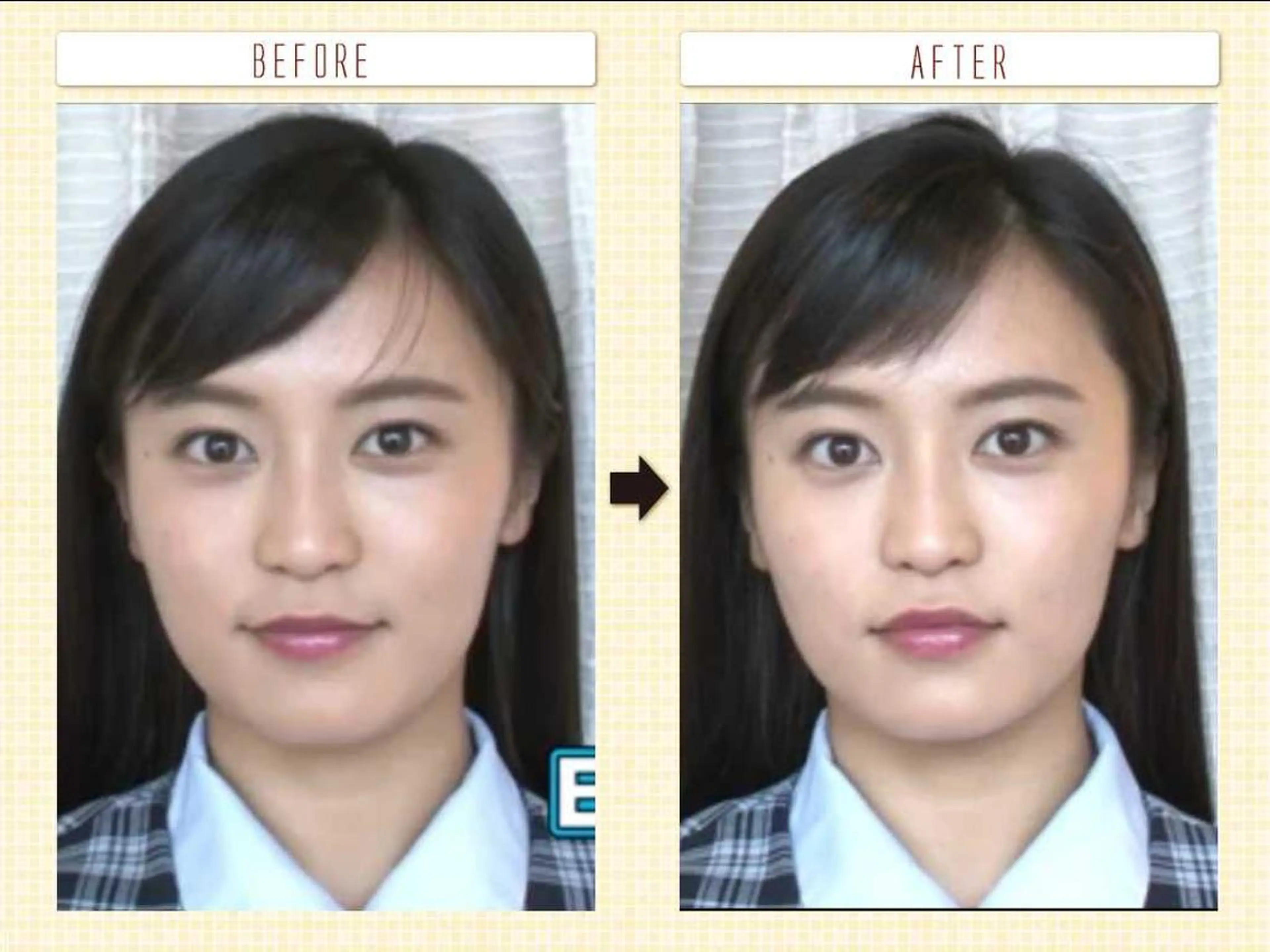 むくみたるみ専門☆ 美容鍼・小顔矯正のエステ・リラクイメージ