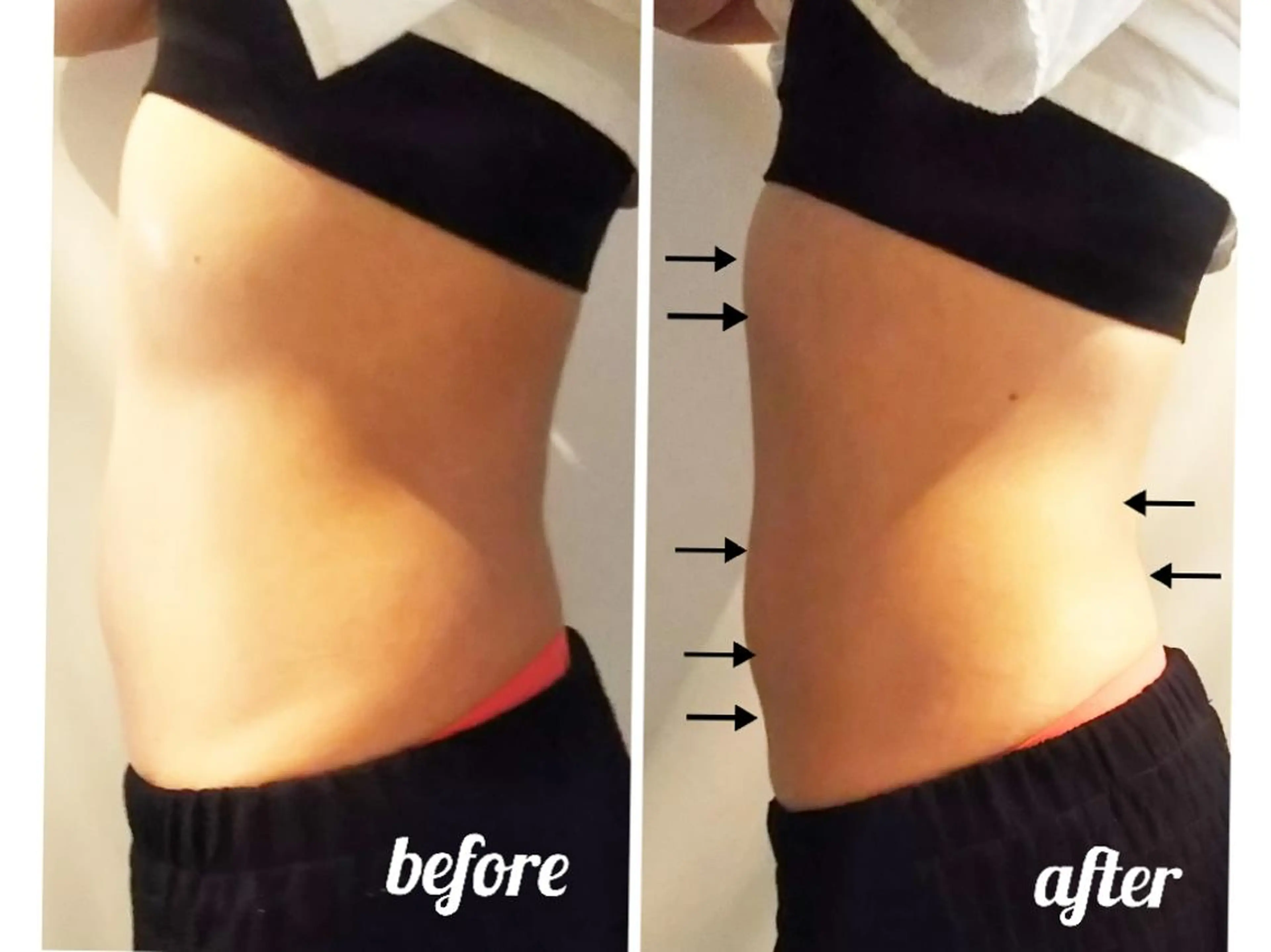 【ニキビ/肌管理】 salon varyのエステ・リラクイメージ