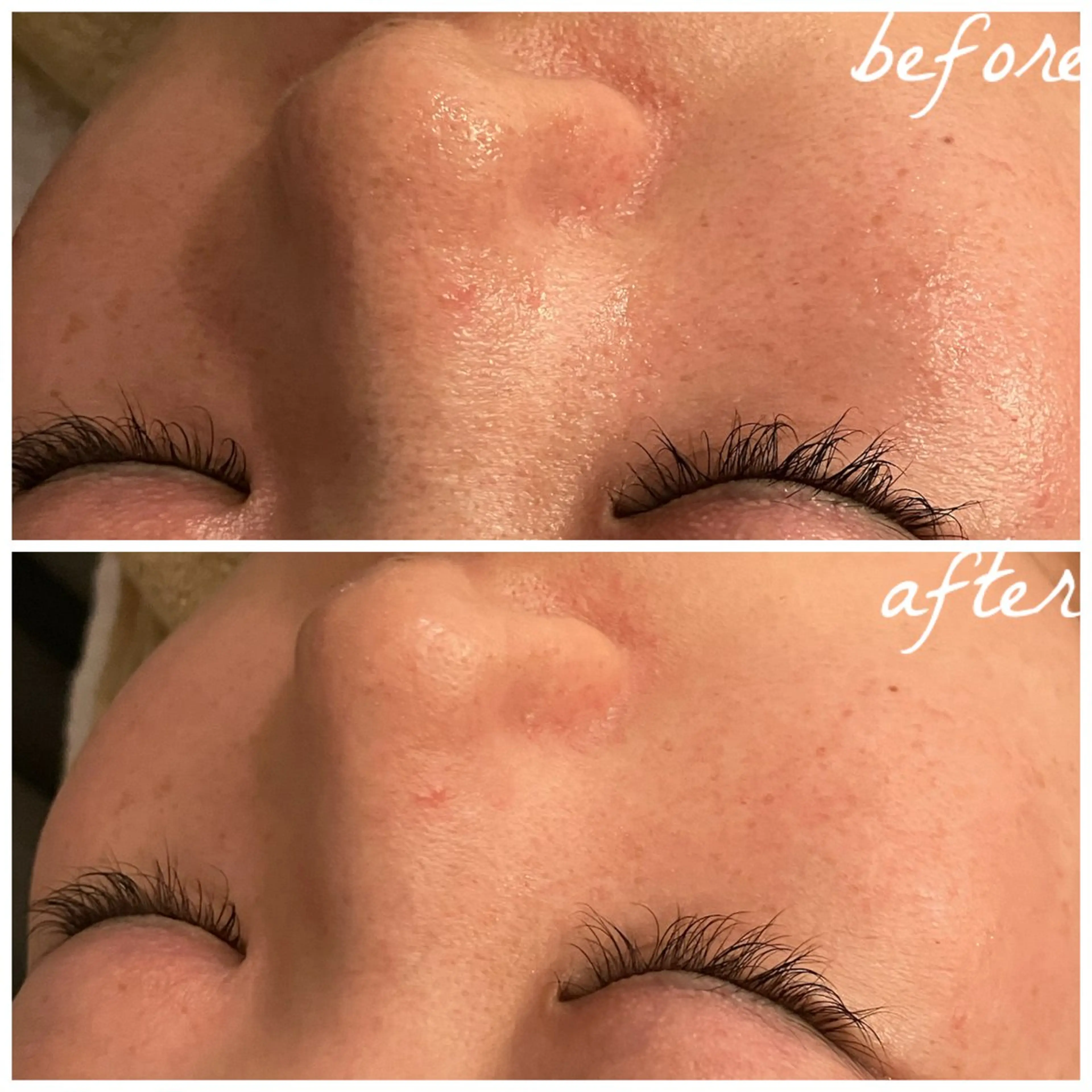 メンズ エステ メナード岐阜茜部 杉浦のエステ・リラクイメージ