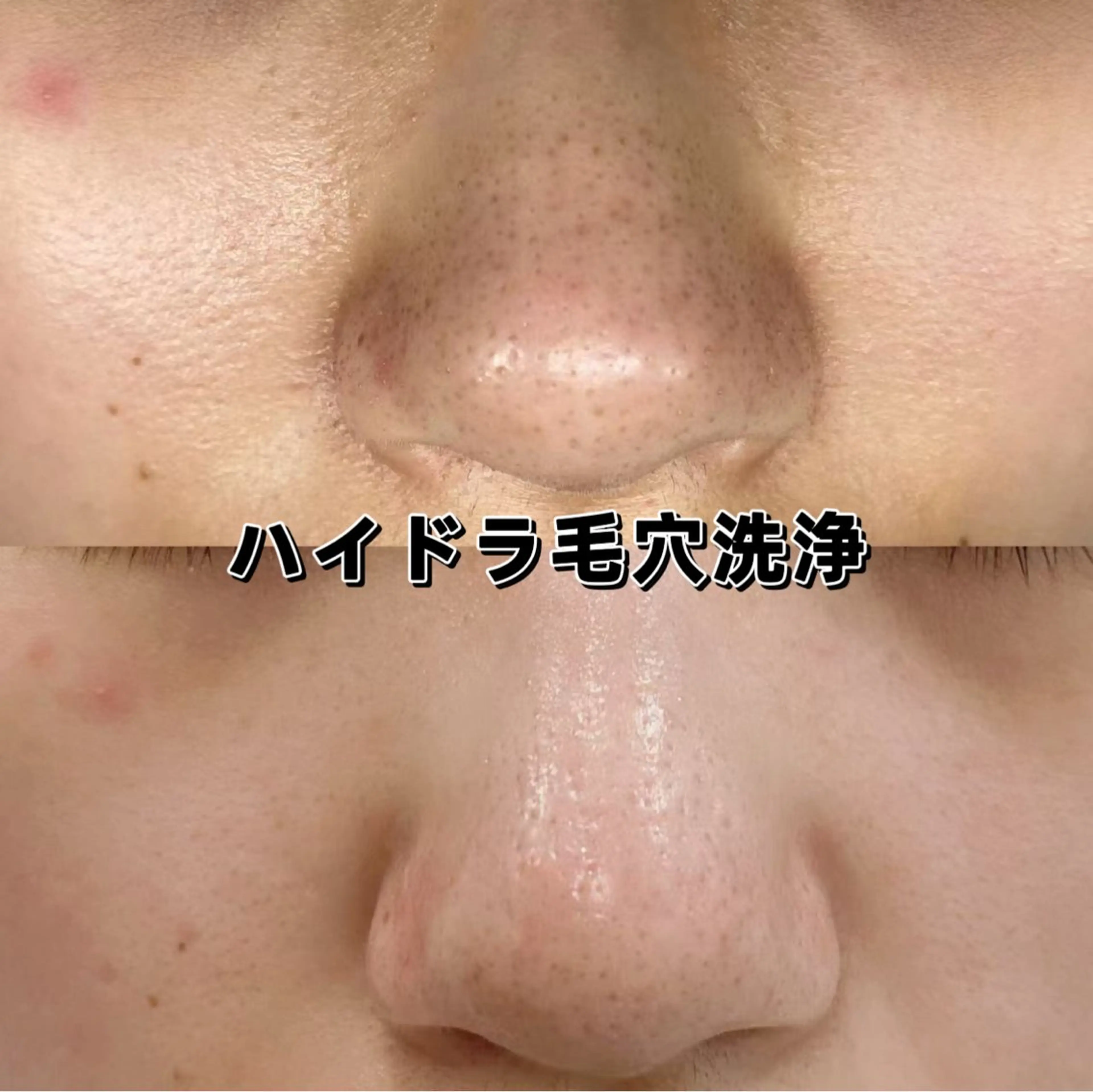 美BELLO 池袋のエステ・リラクイメージ