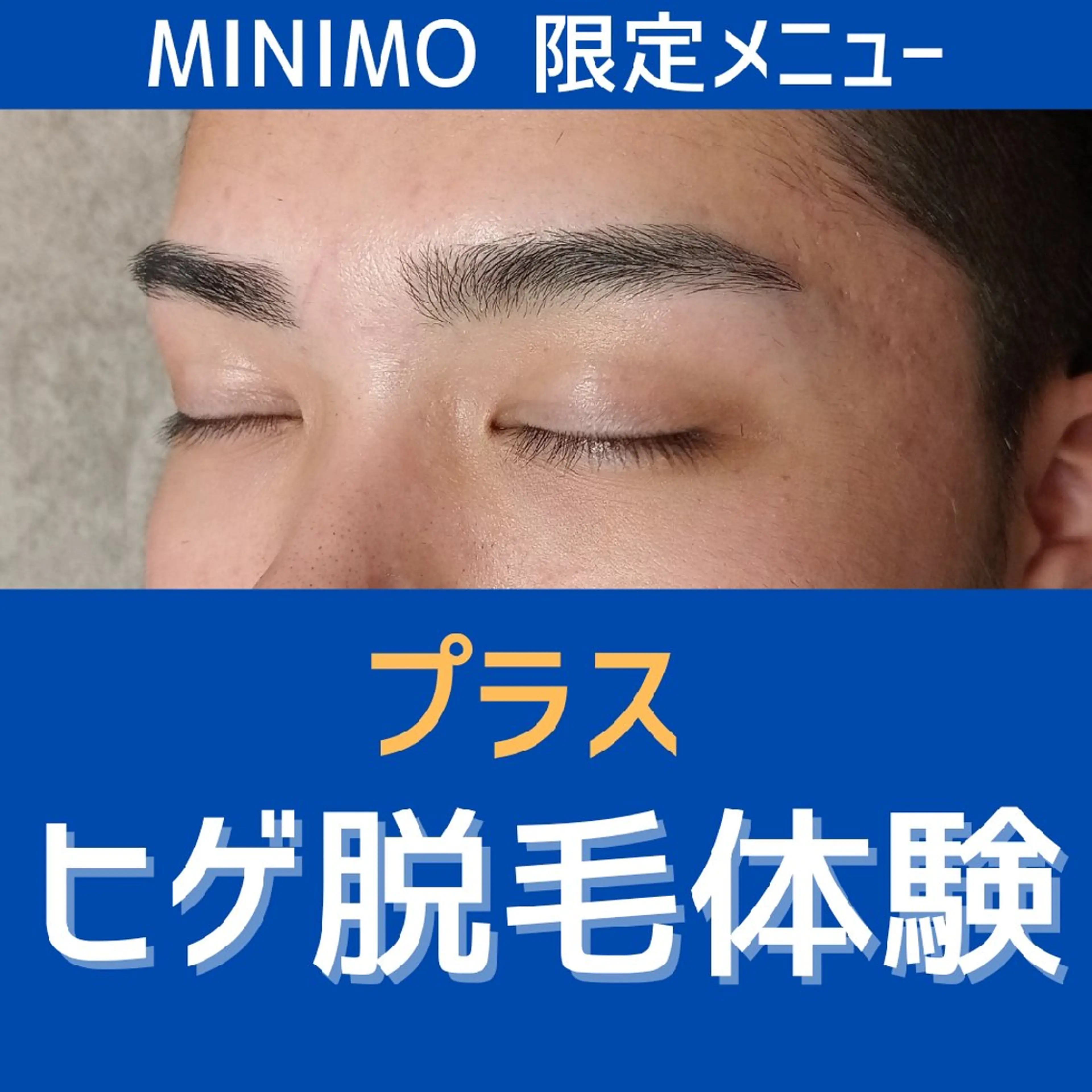 【初回】大人気☆眉毛ワックス＋ヒゲ脱毛【口周り】　※土日祝はプラス500円の写真