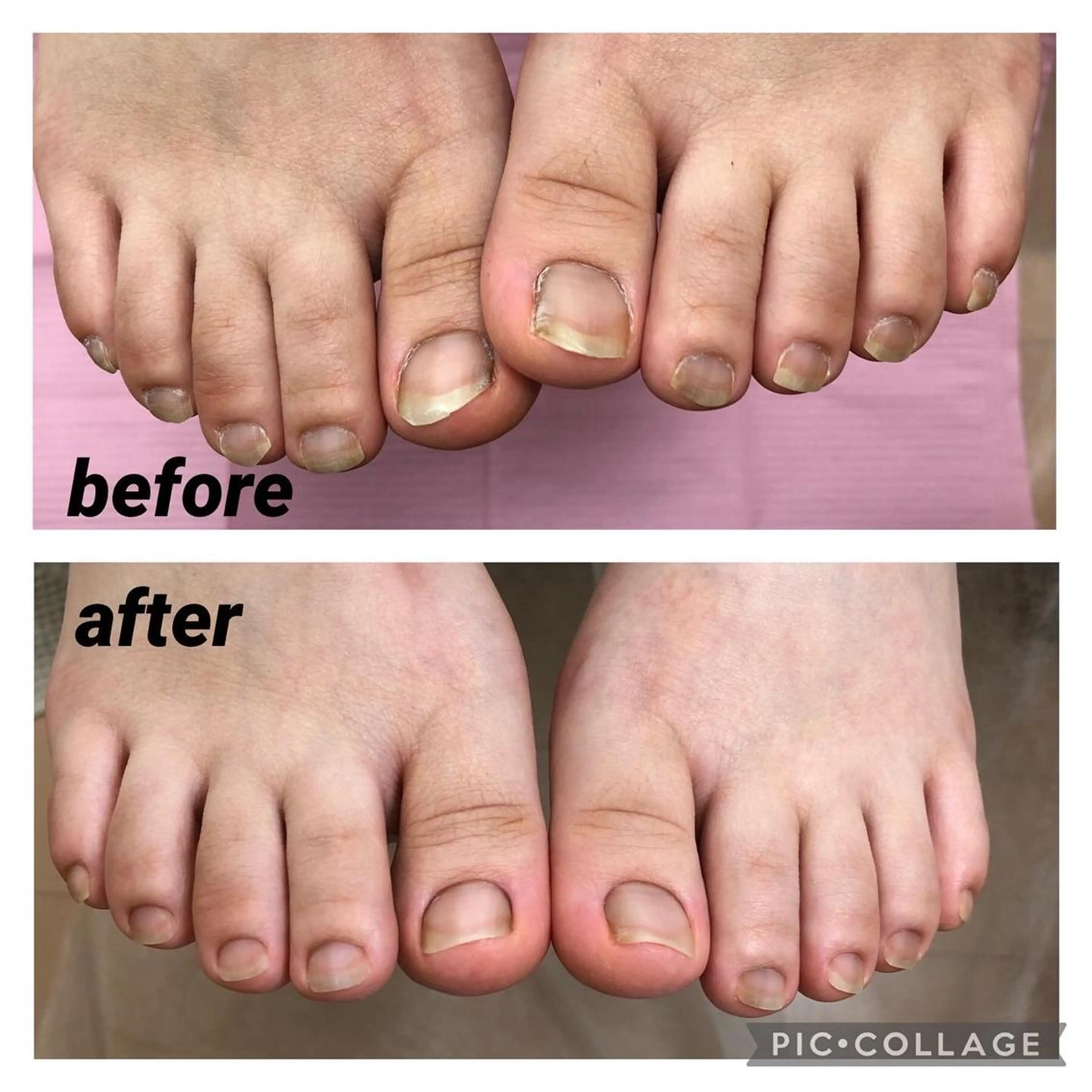 ネイル フットネイル フットネイル 伊藤 美香のその他イメージ