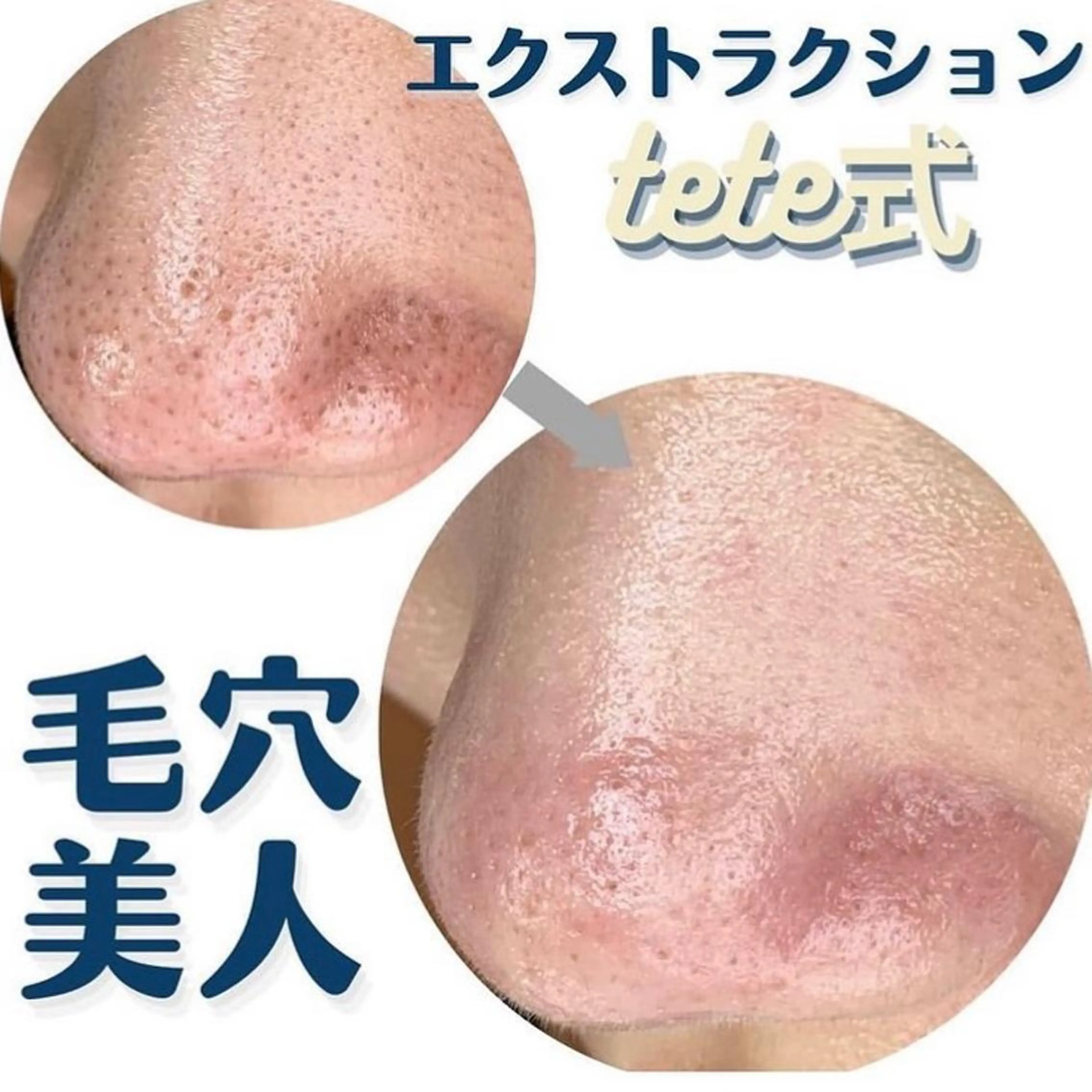 毛穴肌質ケアサロン Yourmeユアミーのエステ・リラクイメージ