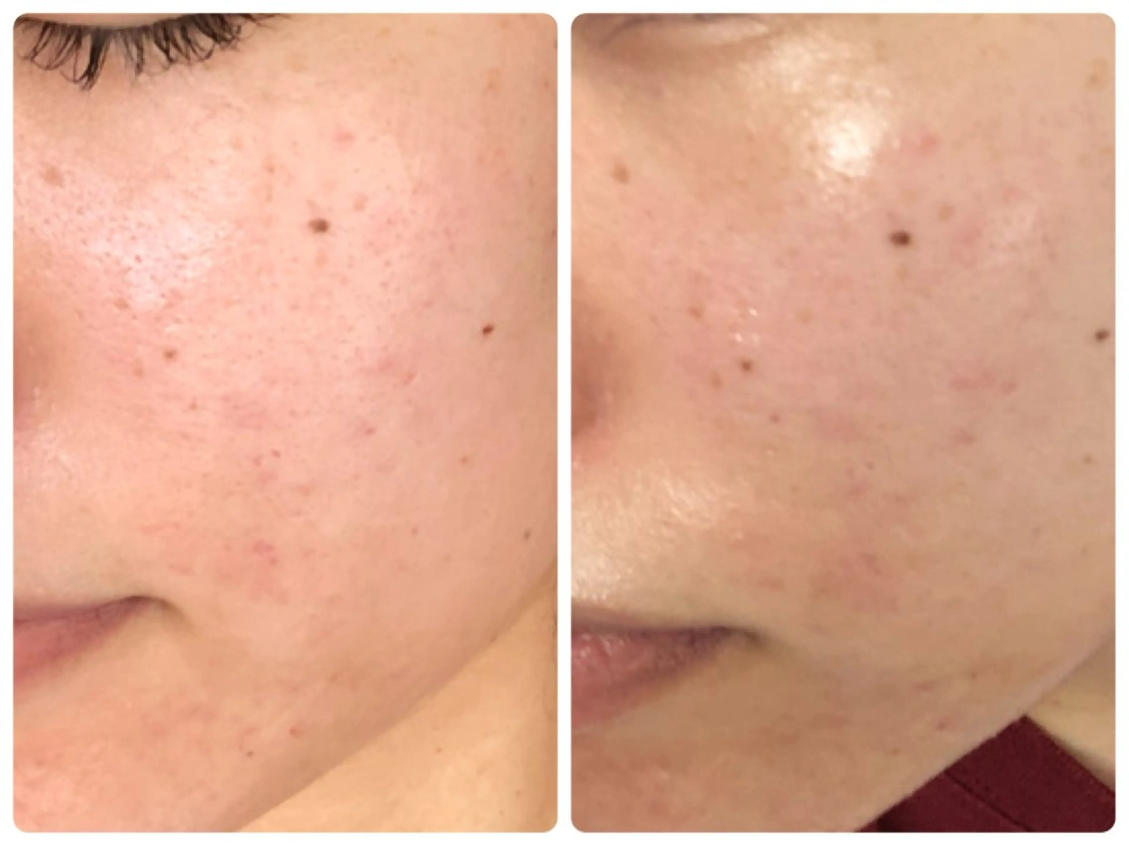 【贅沢美容液パック】超音波エステ+肌悩み別パック❤️の写真