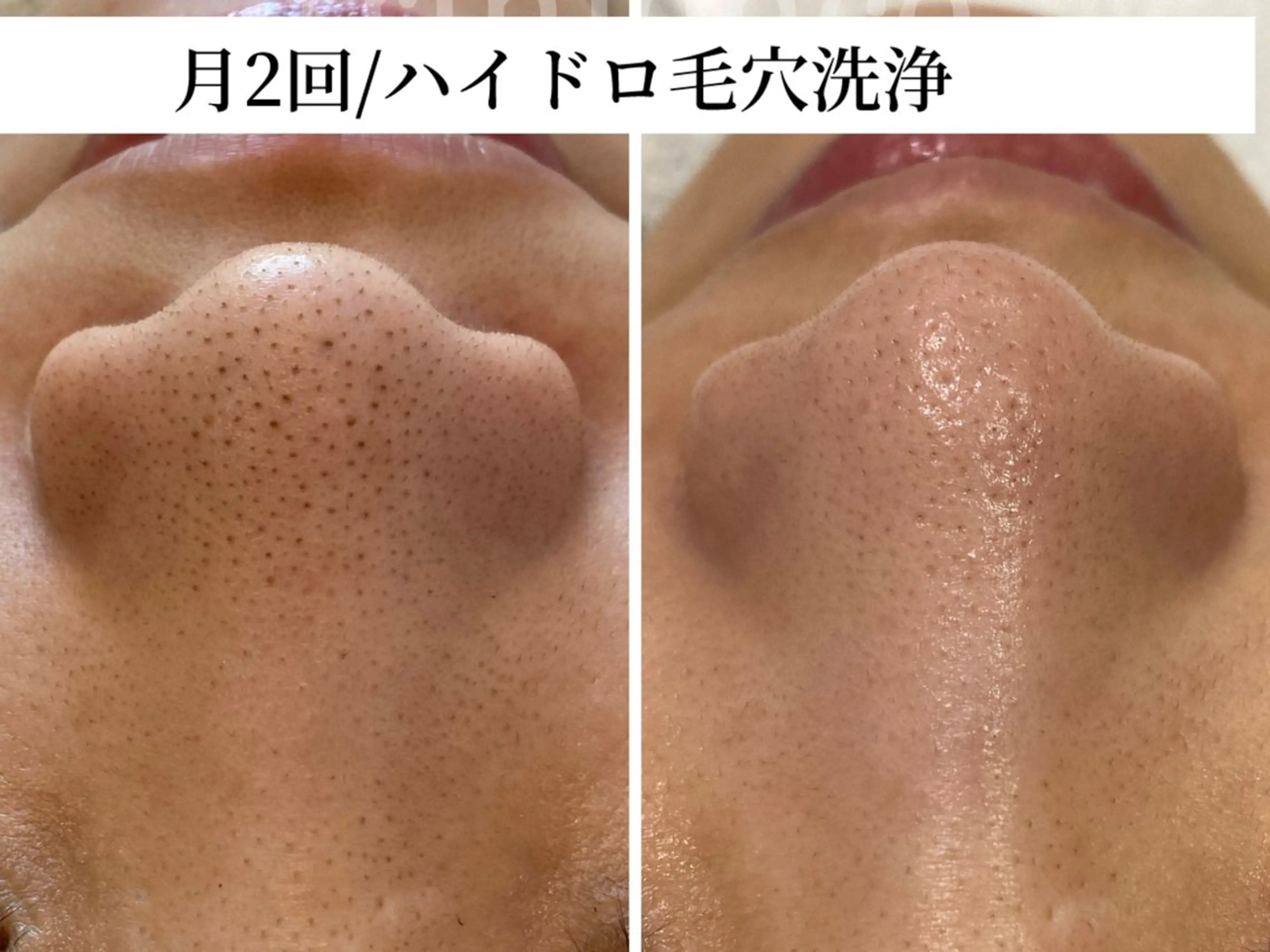 TRINIENCE 南流山店のエステ・リラクイメージ