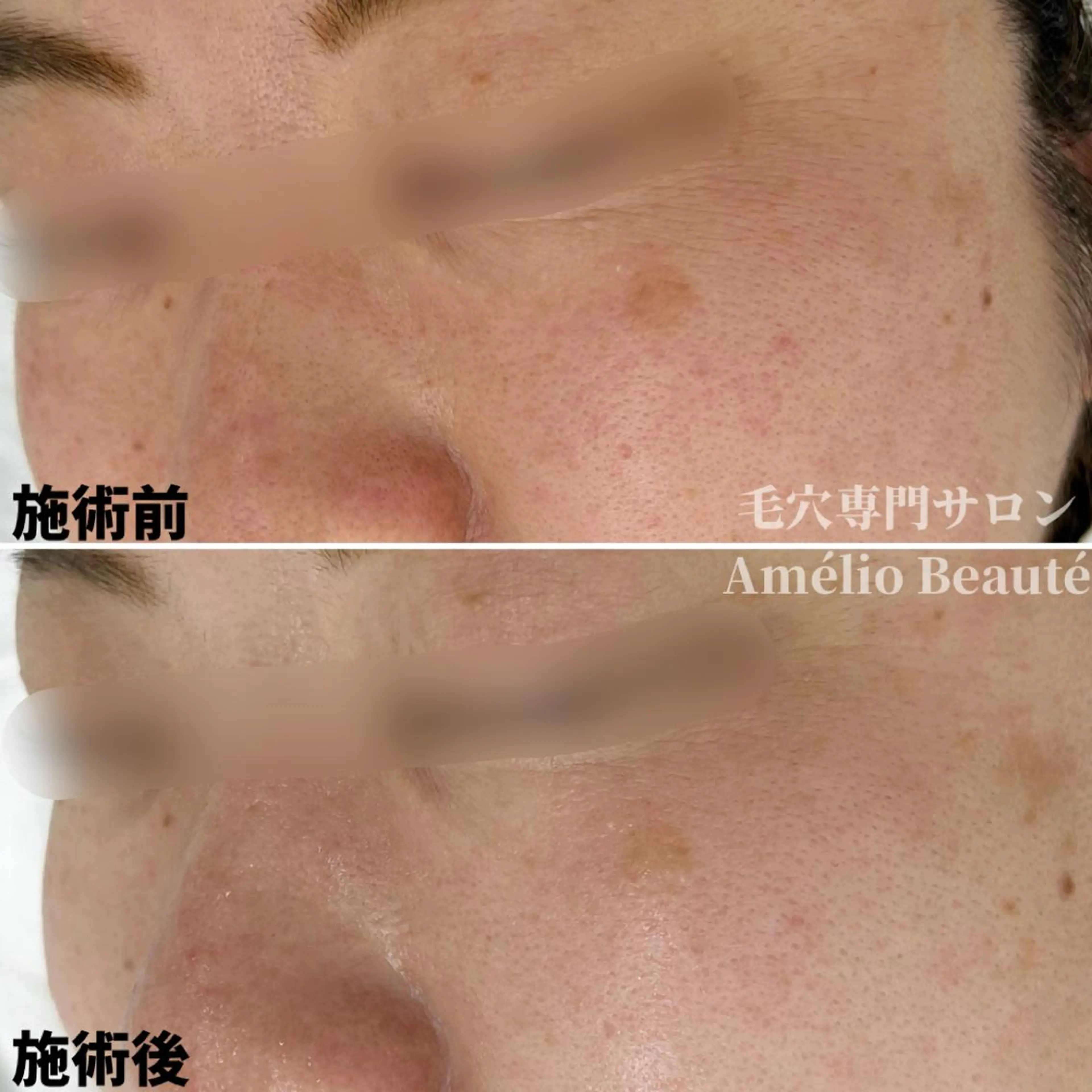 毛穴ケア専門サロン Amélio Beauté所属・毛穴ケア専門サロン アメリオボーテのその他イメージ