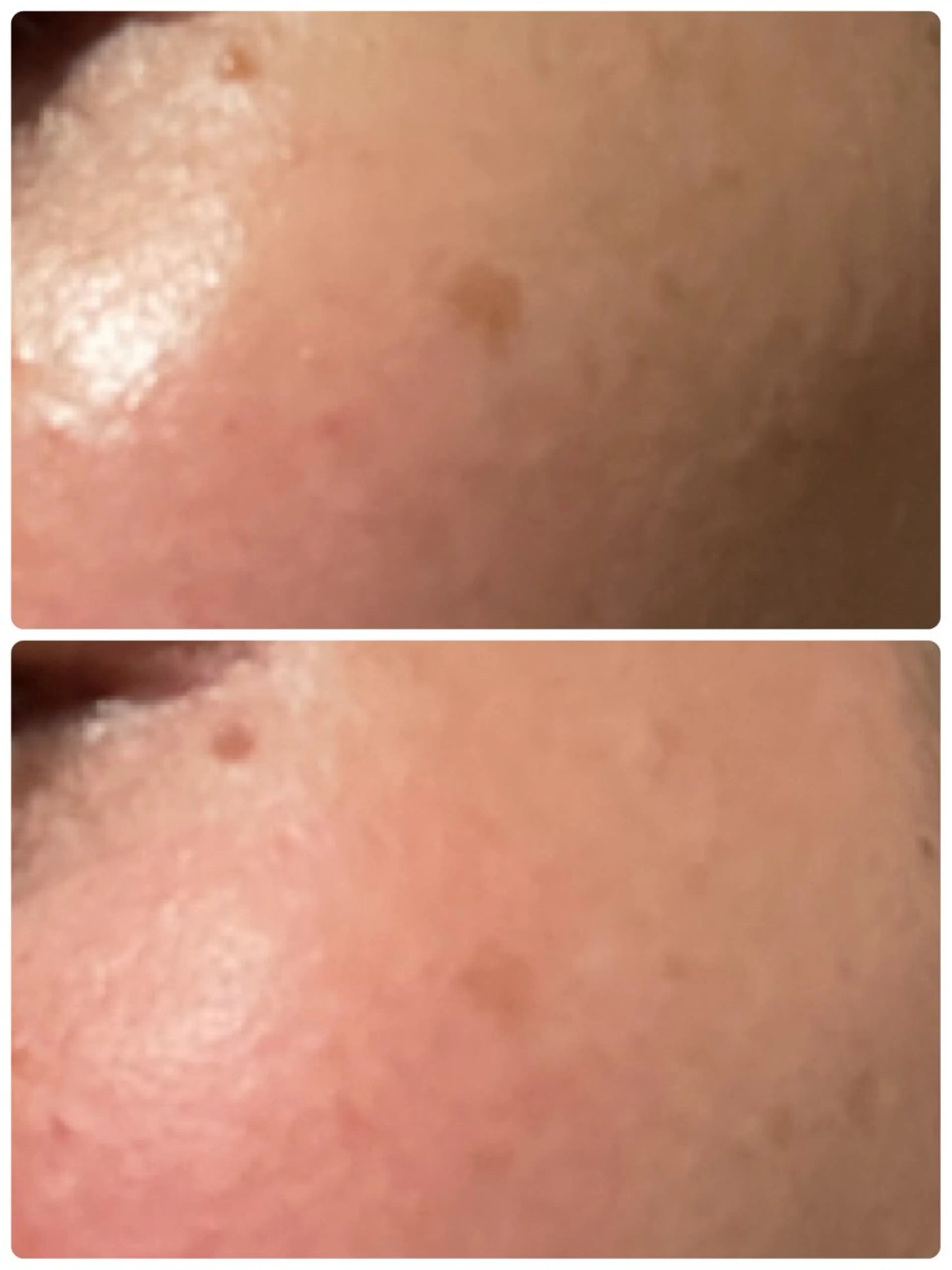 Luce所属・Luce Shokoのエステ・リラクイメージ