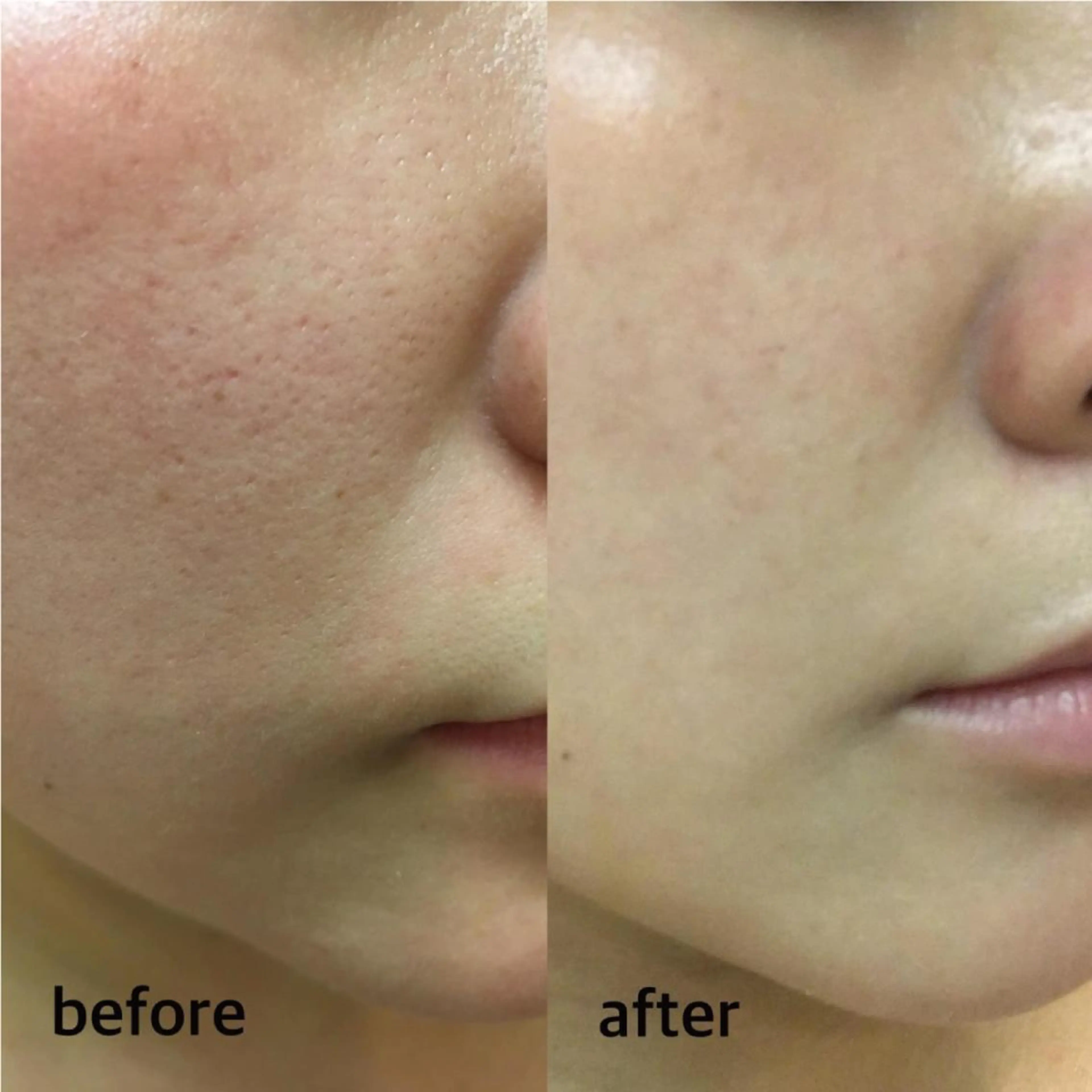 脱毛・眉毛・フェイス サロンN久留米店のその他イメージ