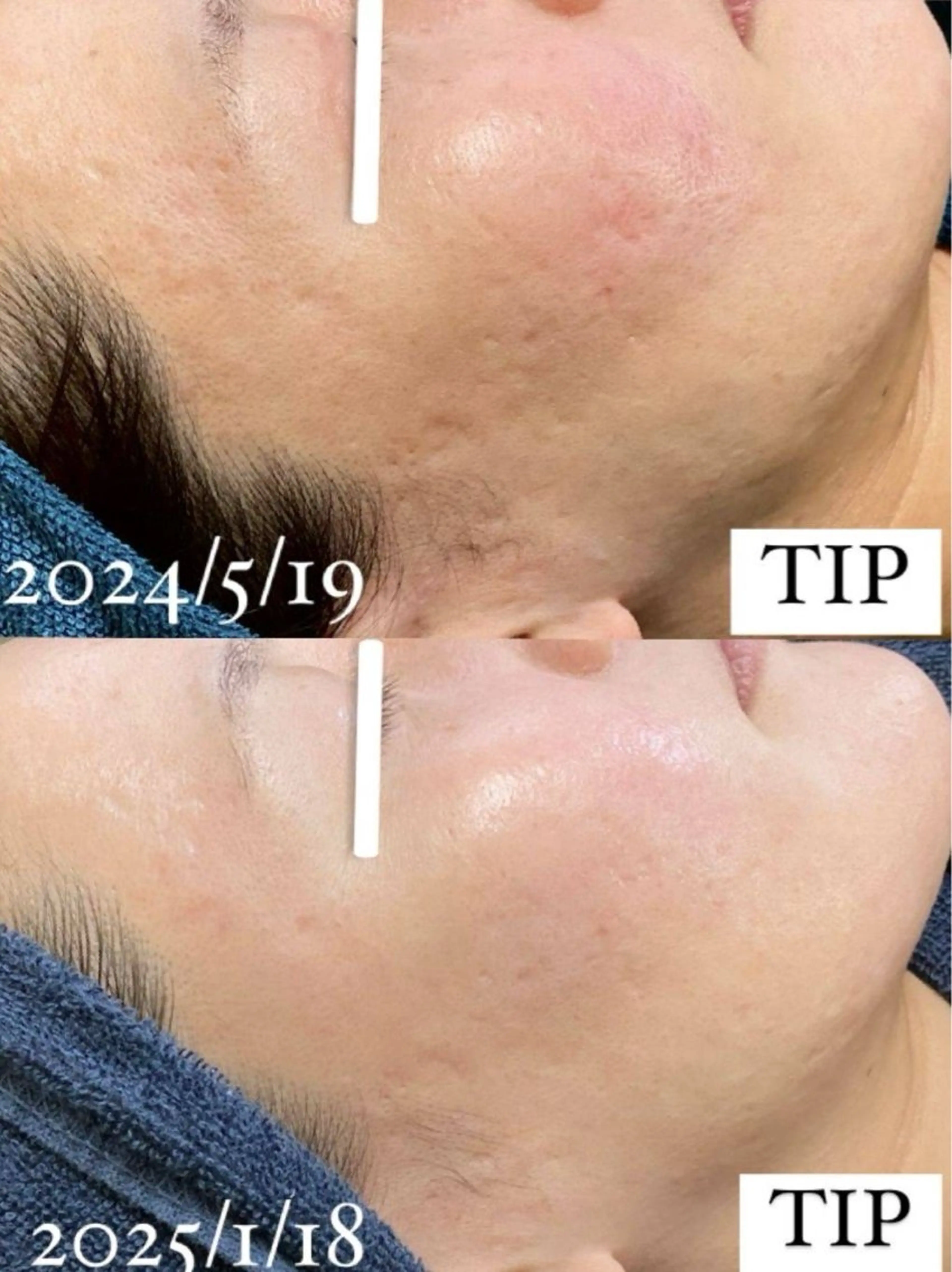 エステ Ellebeauty relaxationのエステ・リラクイメージ