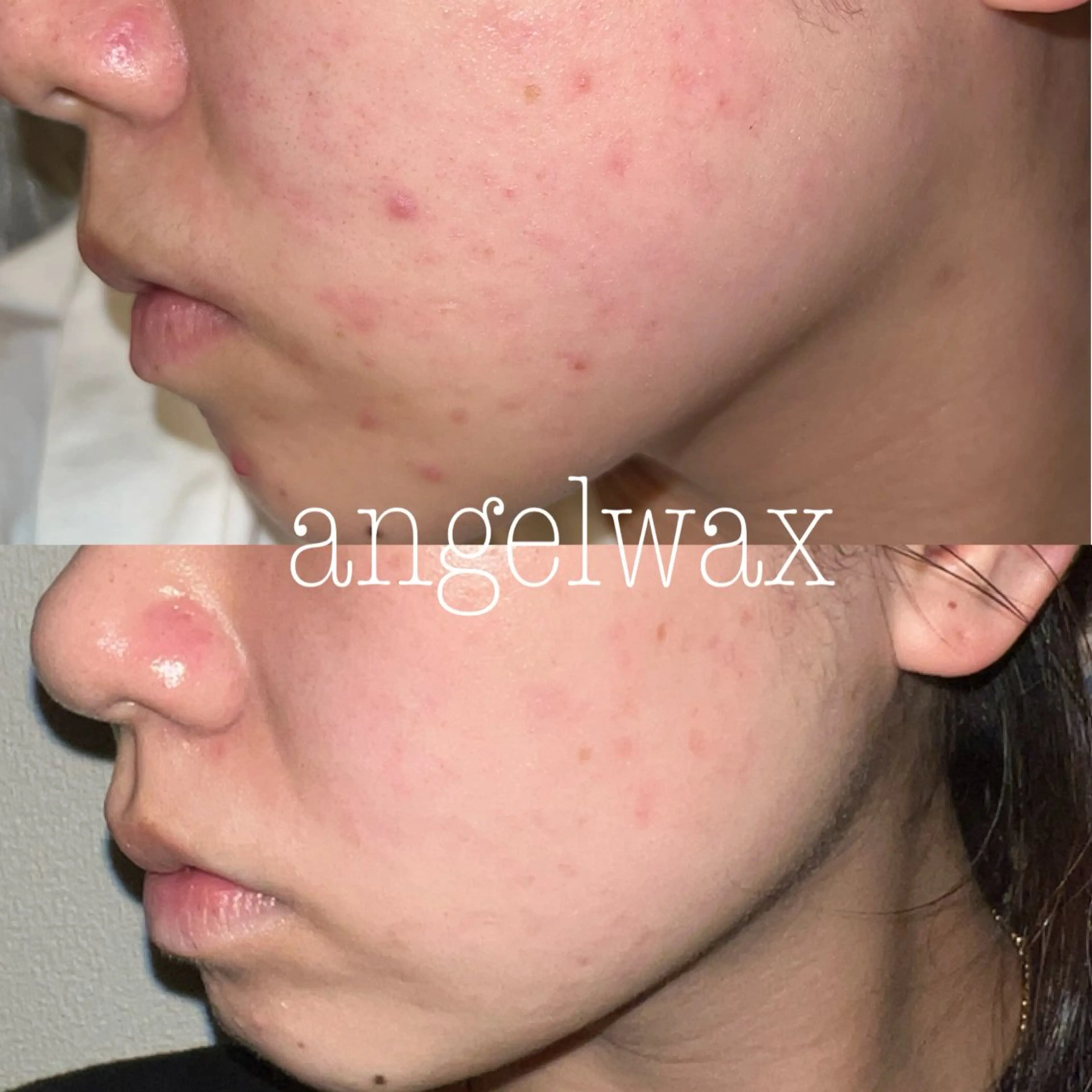 ワックス脱毛サロン 🎀新宿駅徒歩5分のエステ・リラクイメージ