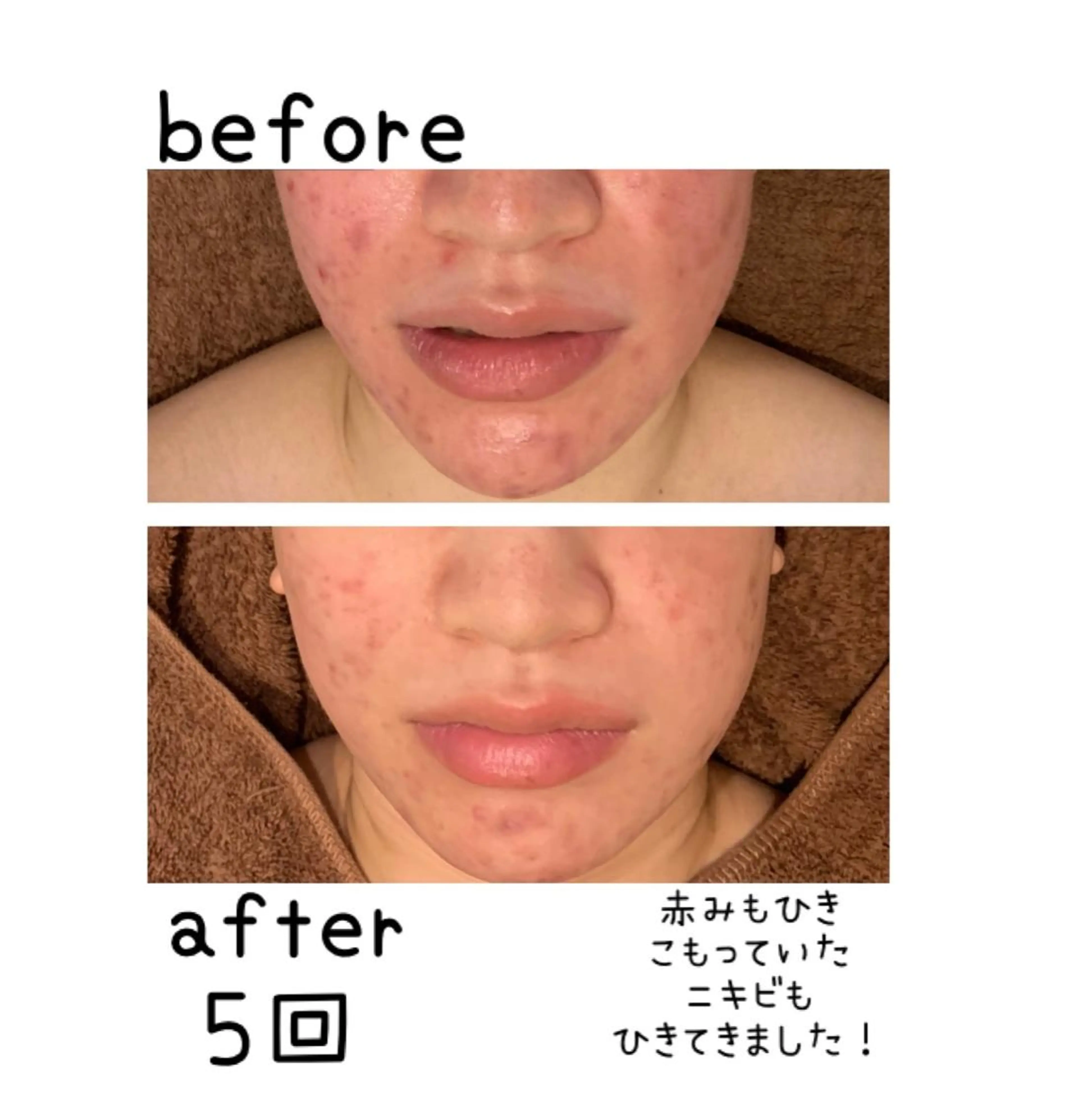 癒し腸もみサロン シャユーム　ゆきなのエステ・リラクイメージ