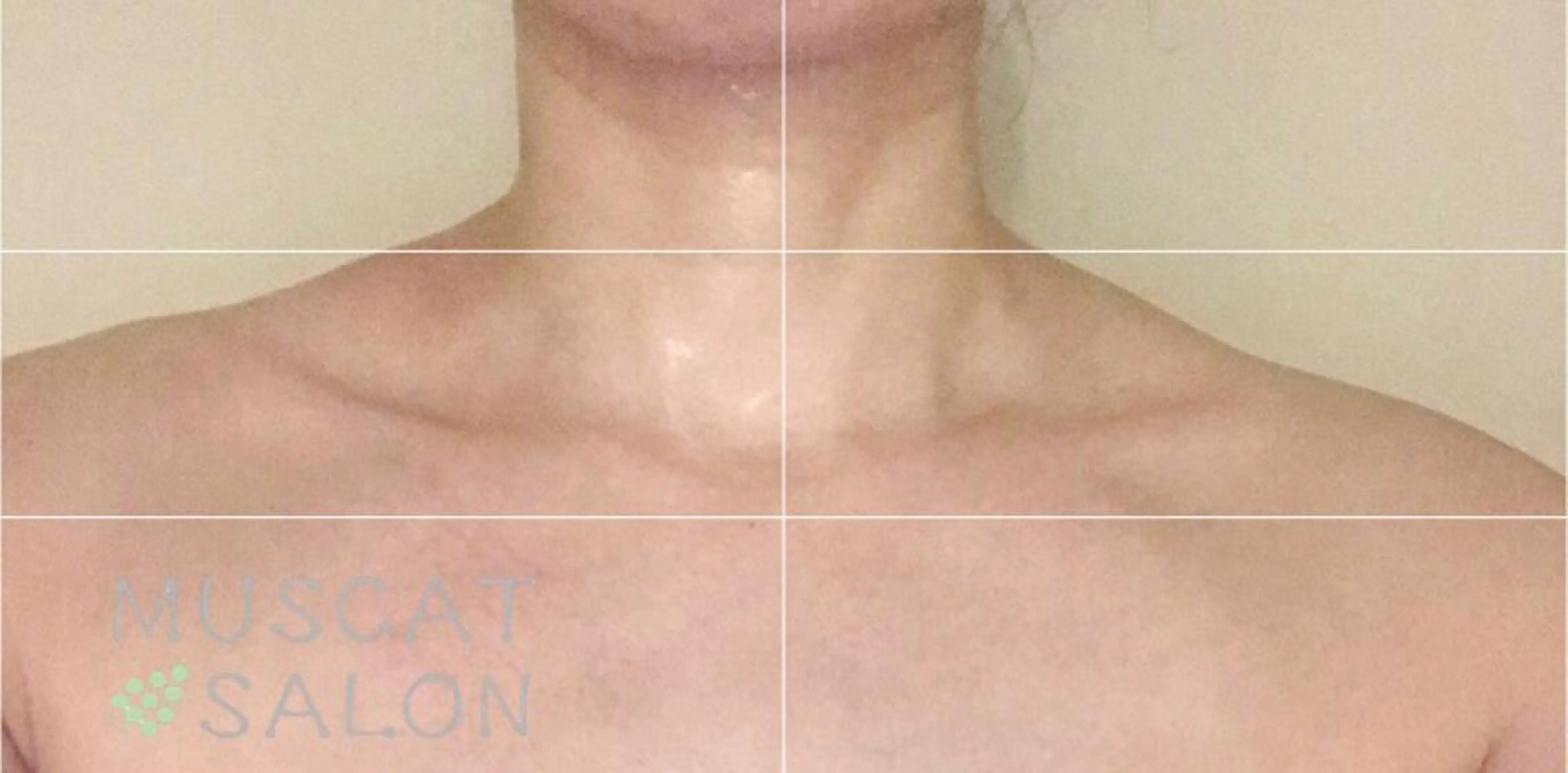 マスカットサロン所属・マスカットサロン 小野寺のエステ・リラクイメージ