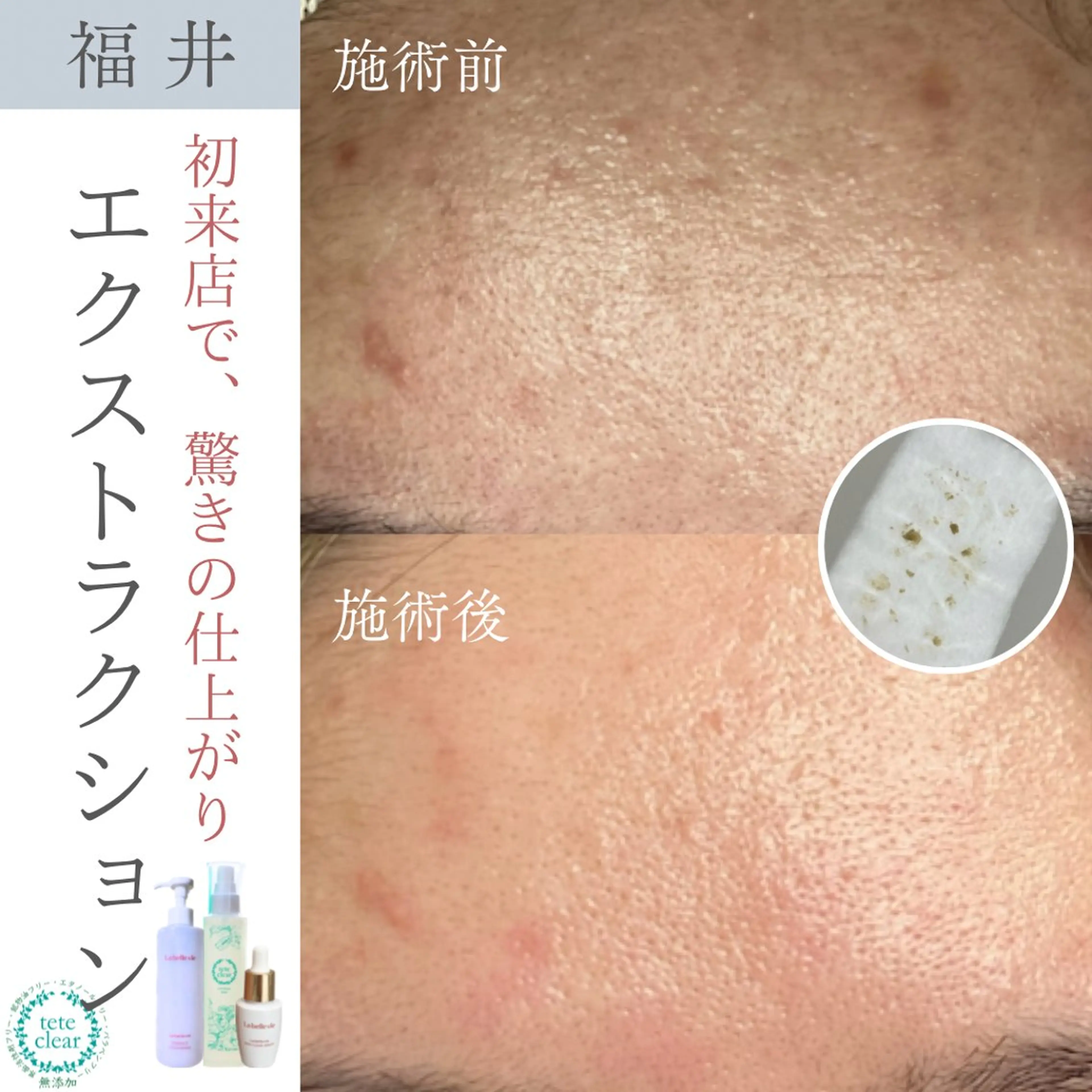 毛穴肌質ケアサロン Yourmeユアミーのエステ・リラクイメージ