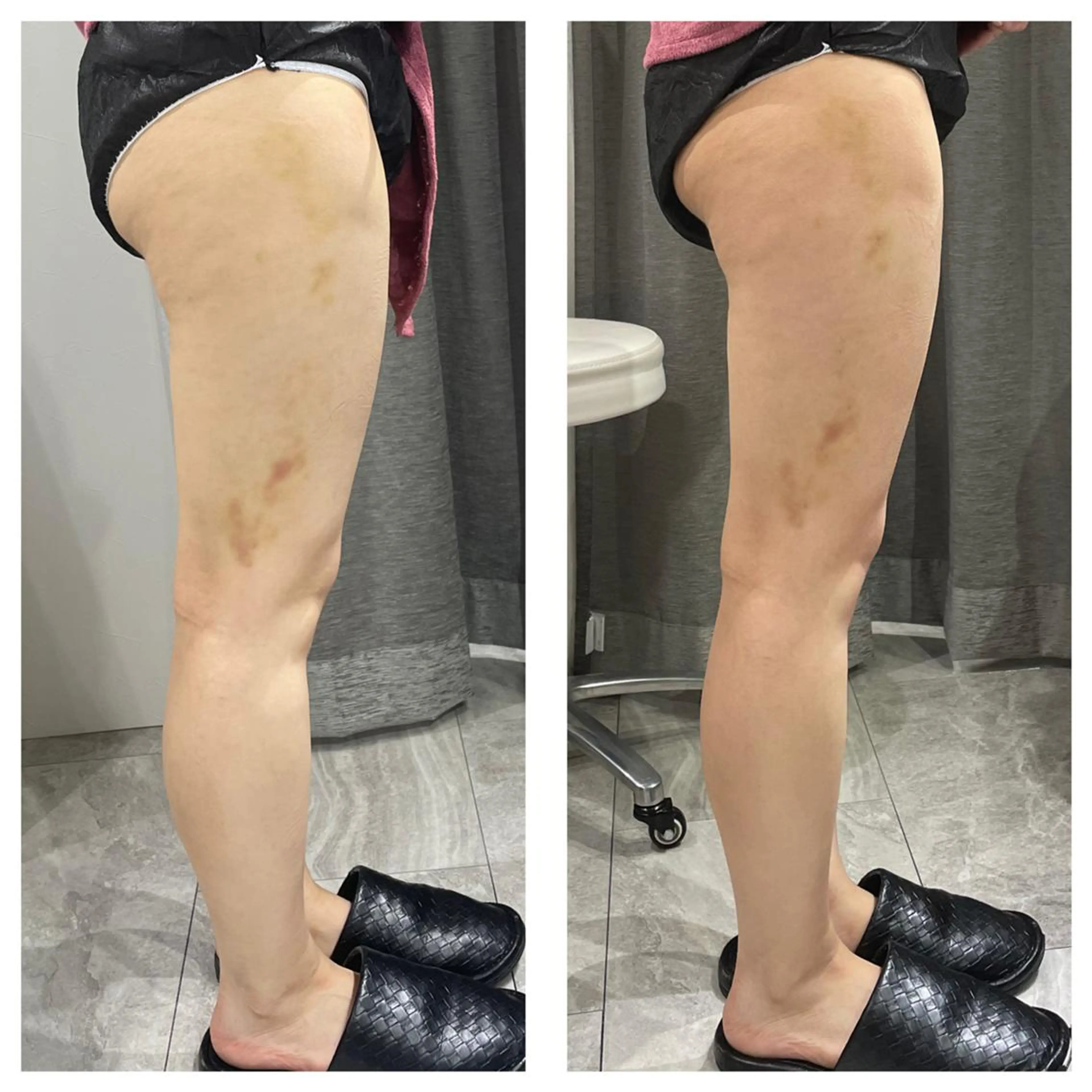 エステ リラク 部分痩せ♥️小顔専門 MIKUのエステ・リラクイメージ