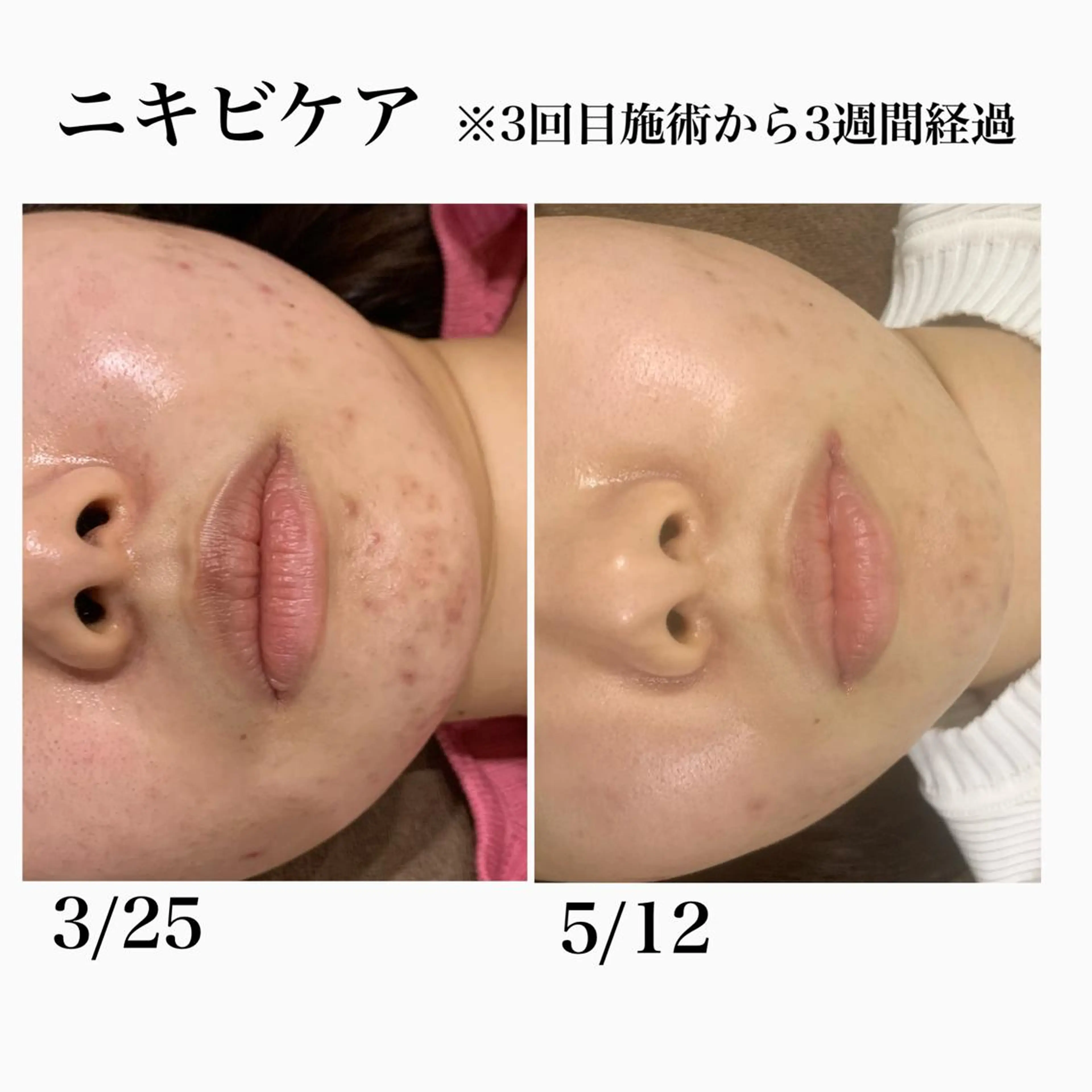 堀之内宏次 ［美容鍼灸師］のエステ・リラクイメージ