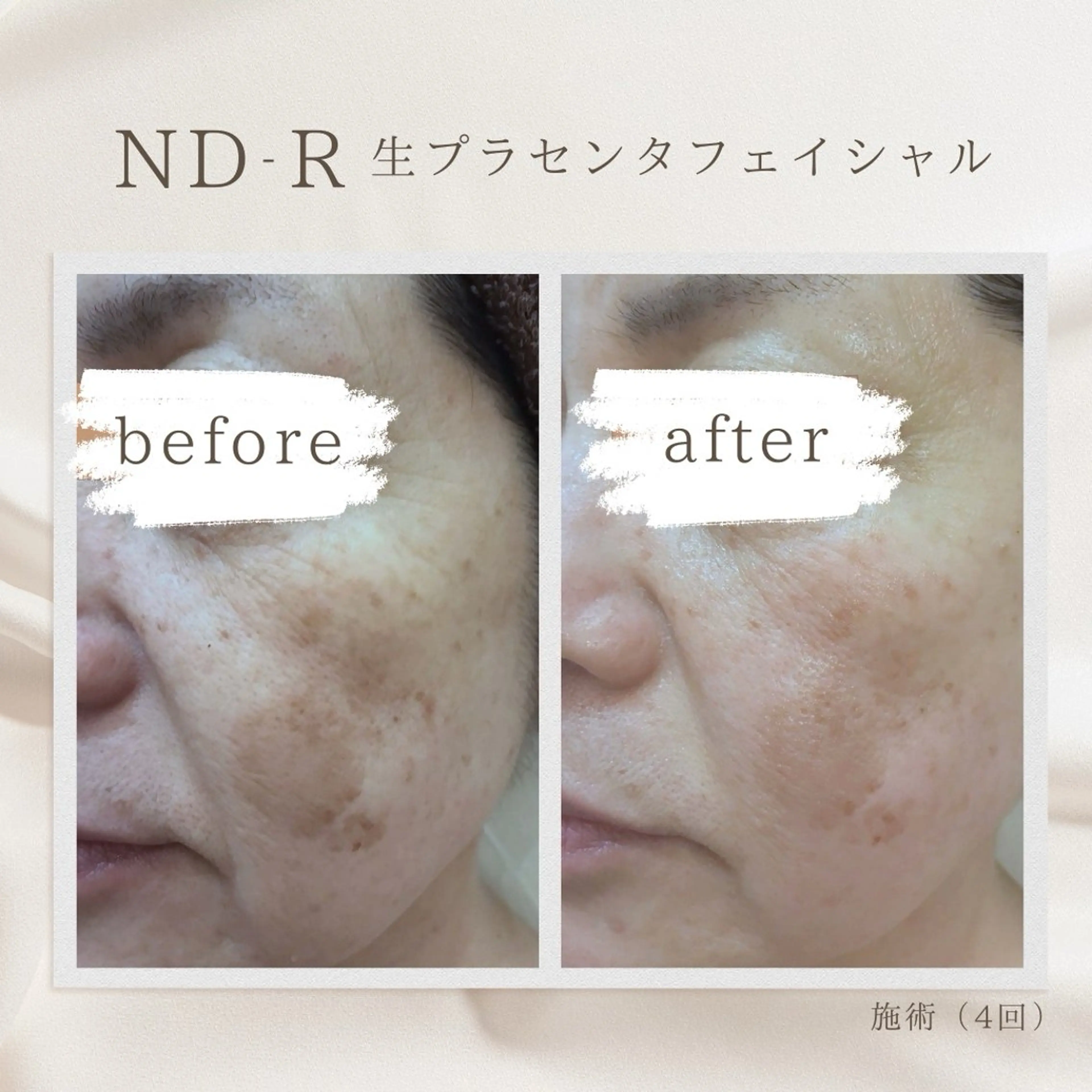 Charm ✿suzuのエステ・リラクイメージ