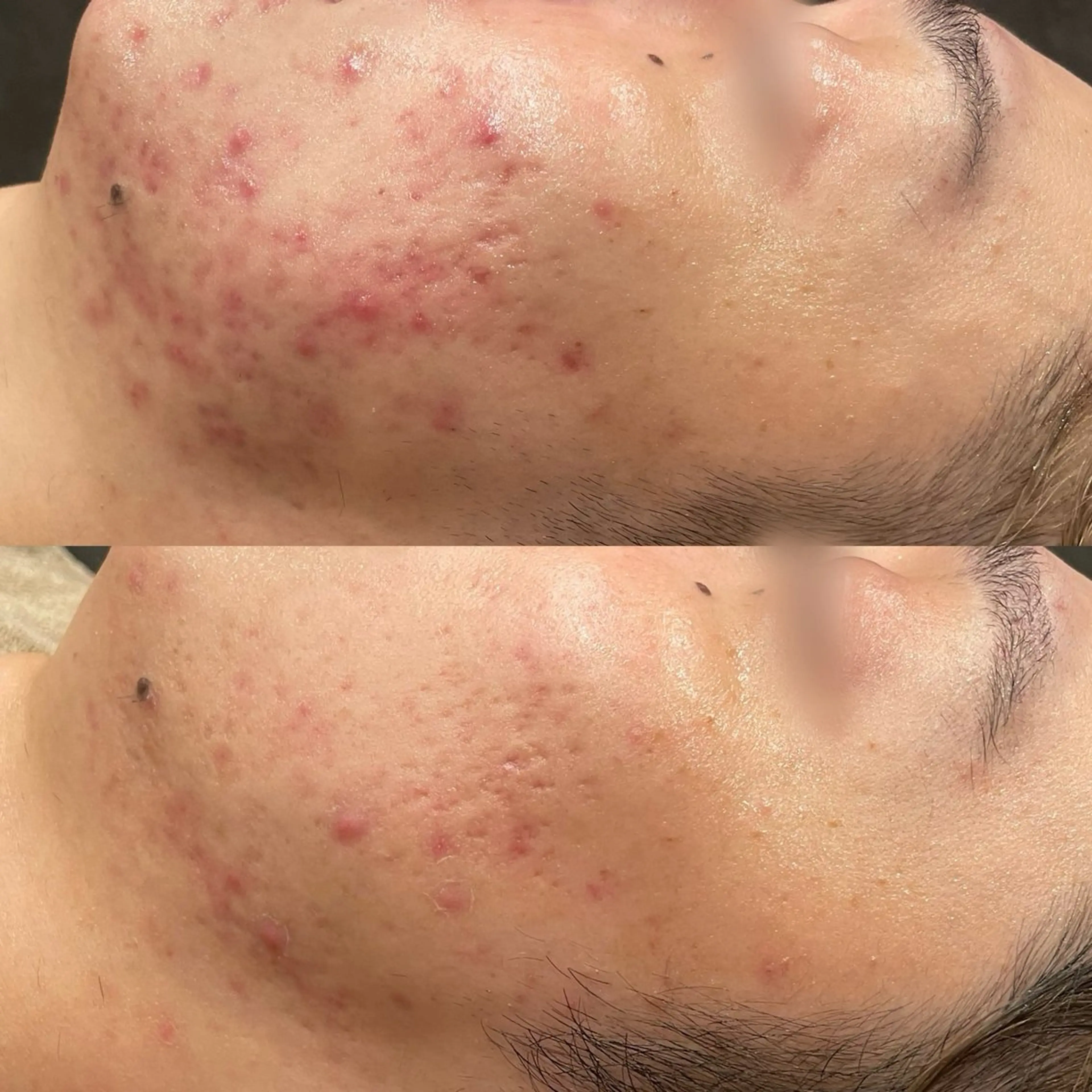 エステ Re:Belle所属・Re:Belle 久留米 : 中島のエステ・リラクイメージ