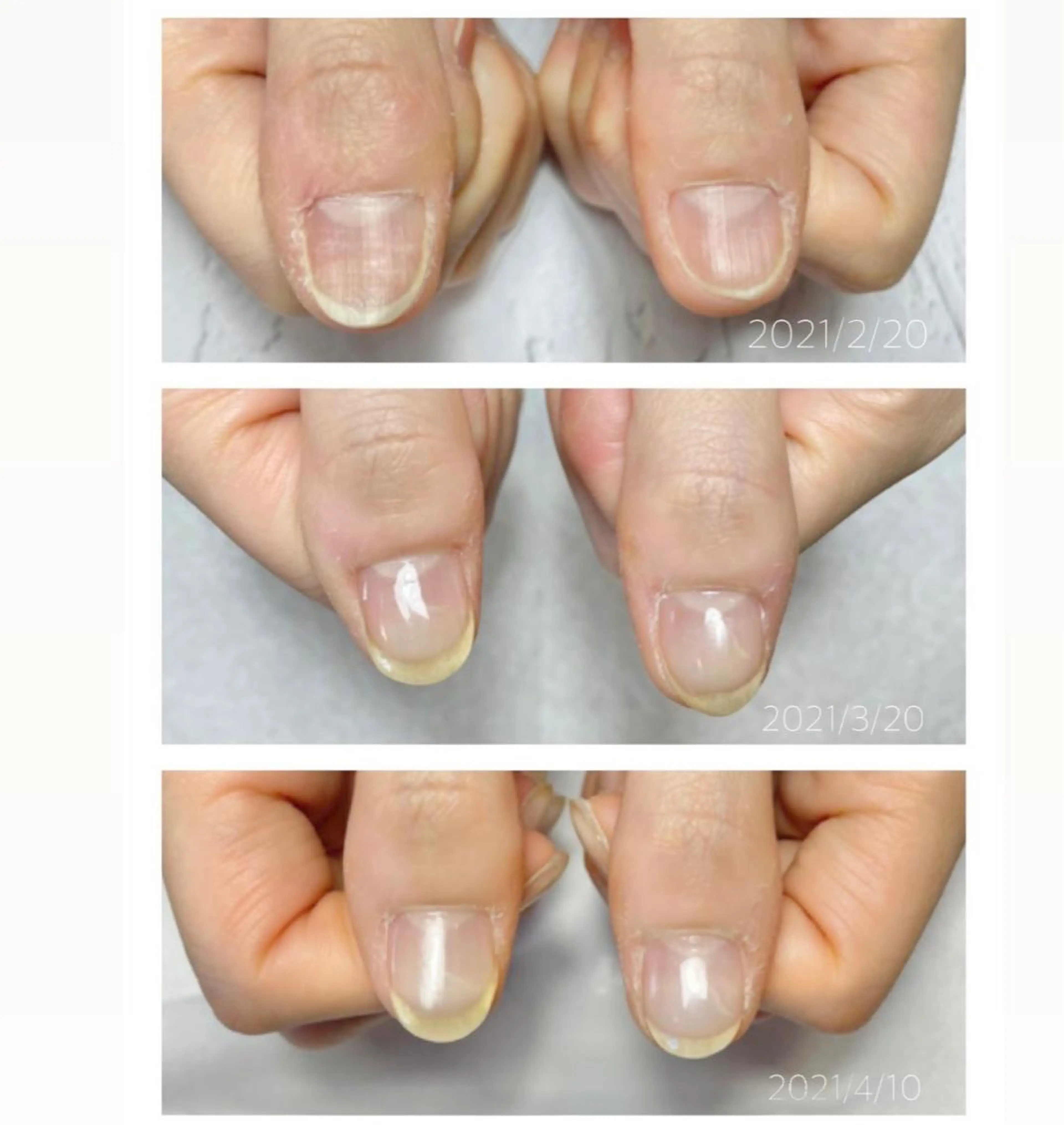 みんなにバレない"育成ネイル"   (ネイルオイル込み)の写真