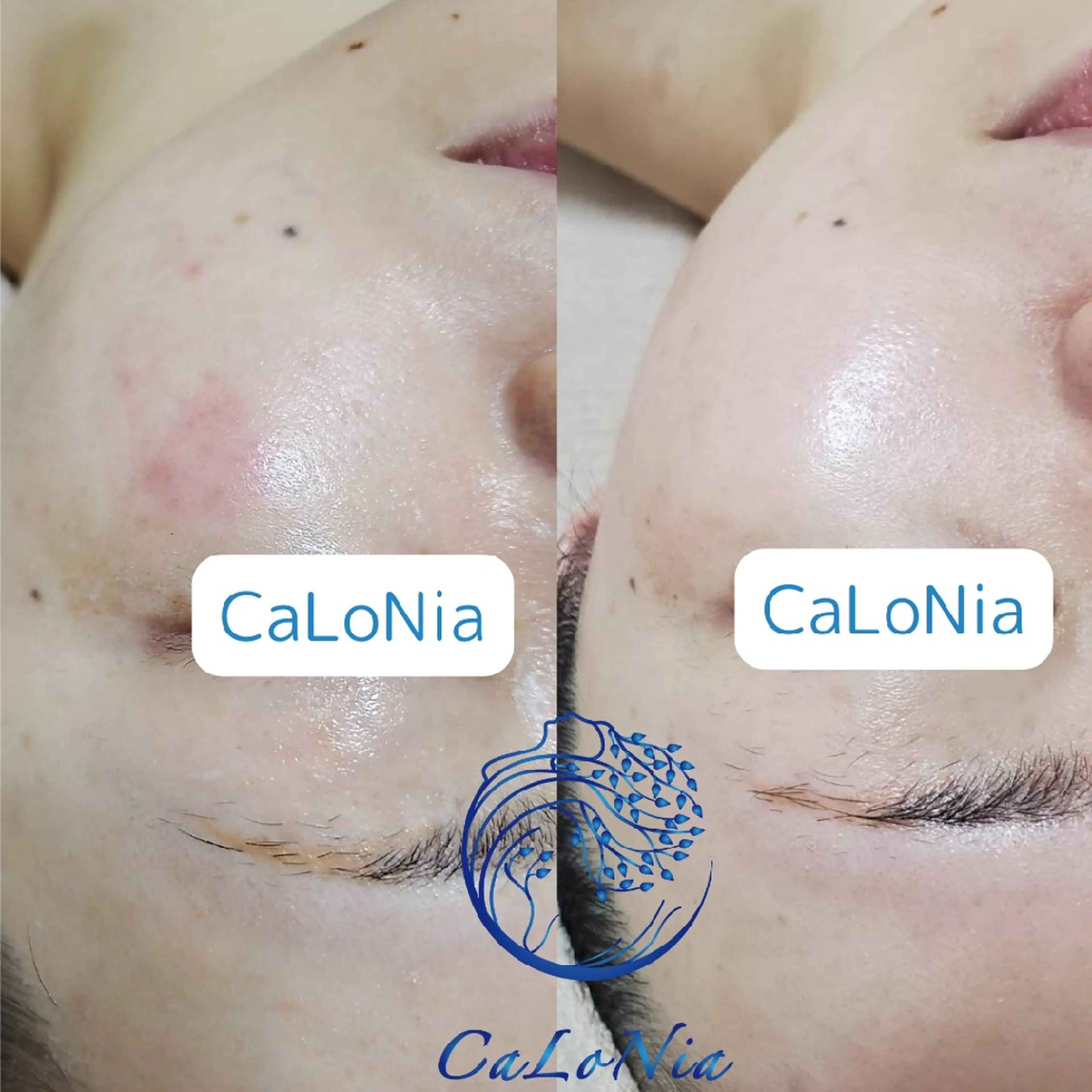 肌質改善・艶髪サロン CaLoNiaのエステ・リラクイメージ