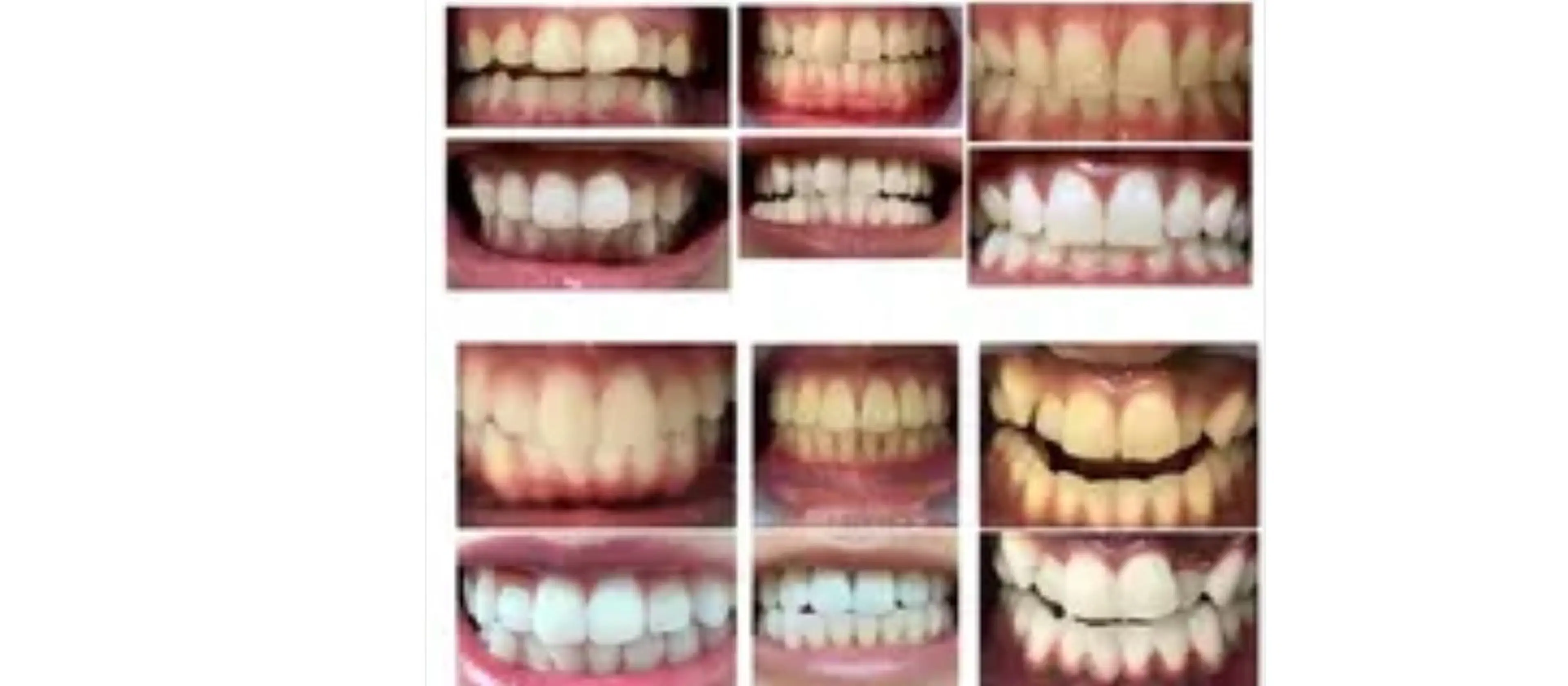 WHITENING ハウスのマツエク・マツパデザイン