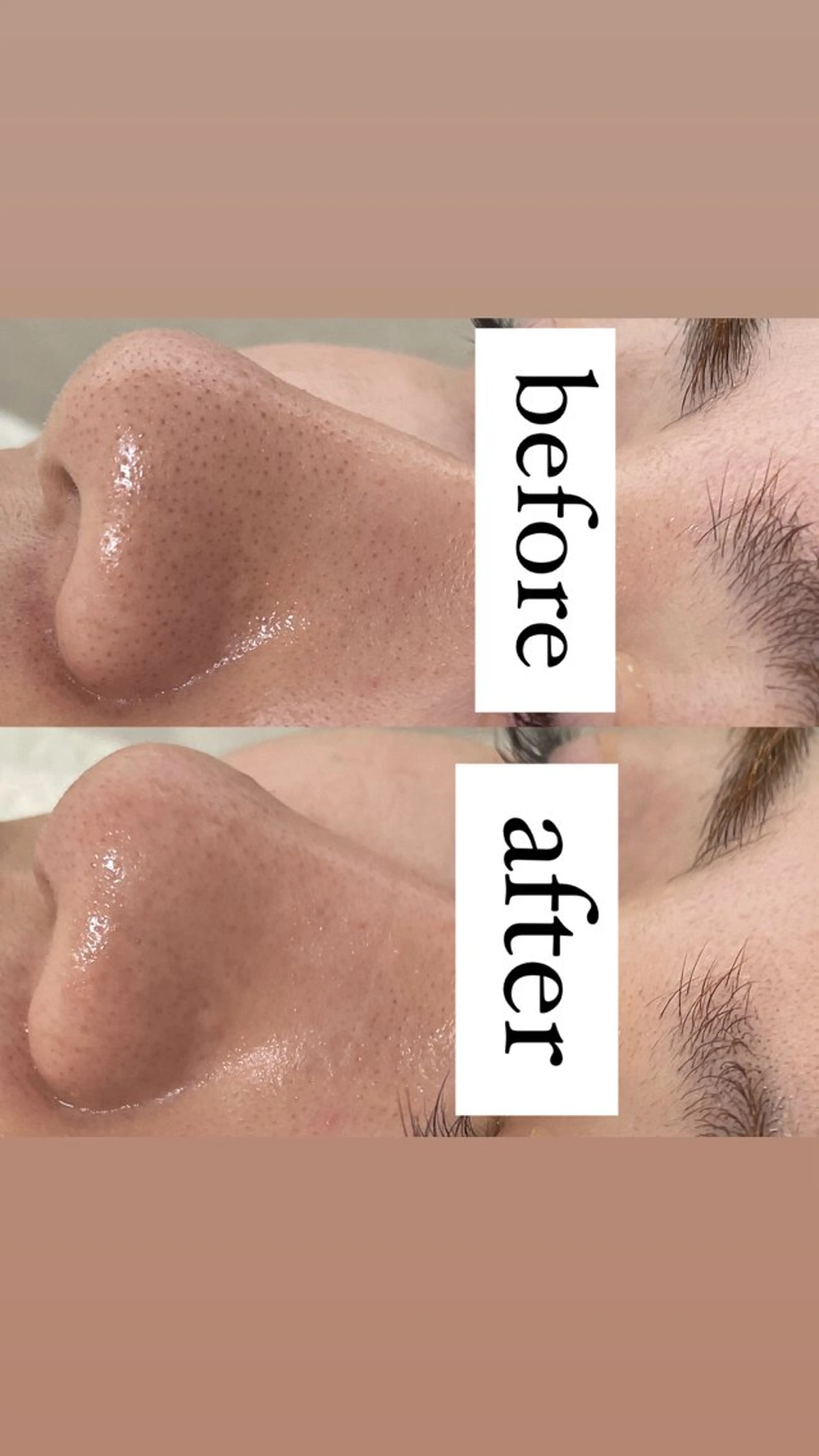 エステ Eve [nail ＊wax＊HBL]のネイルデザイン