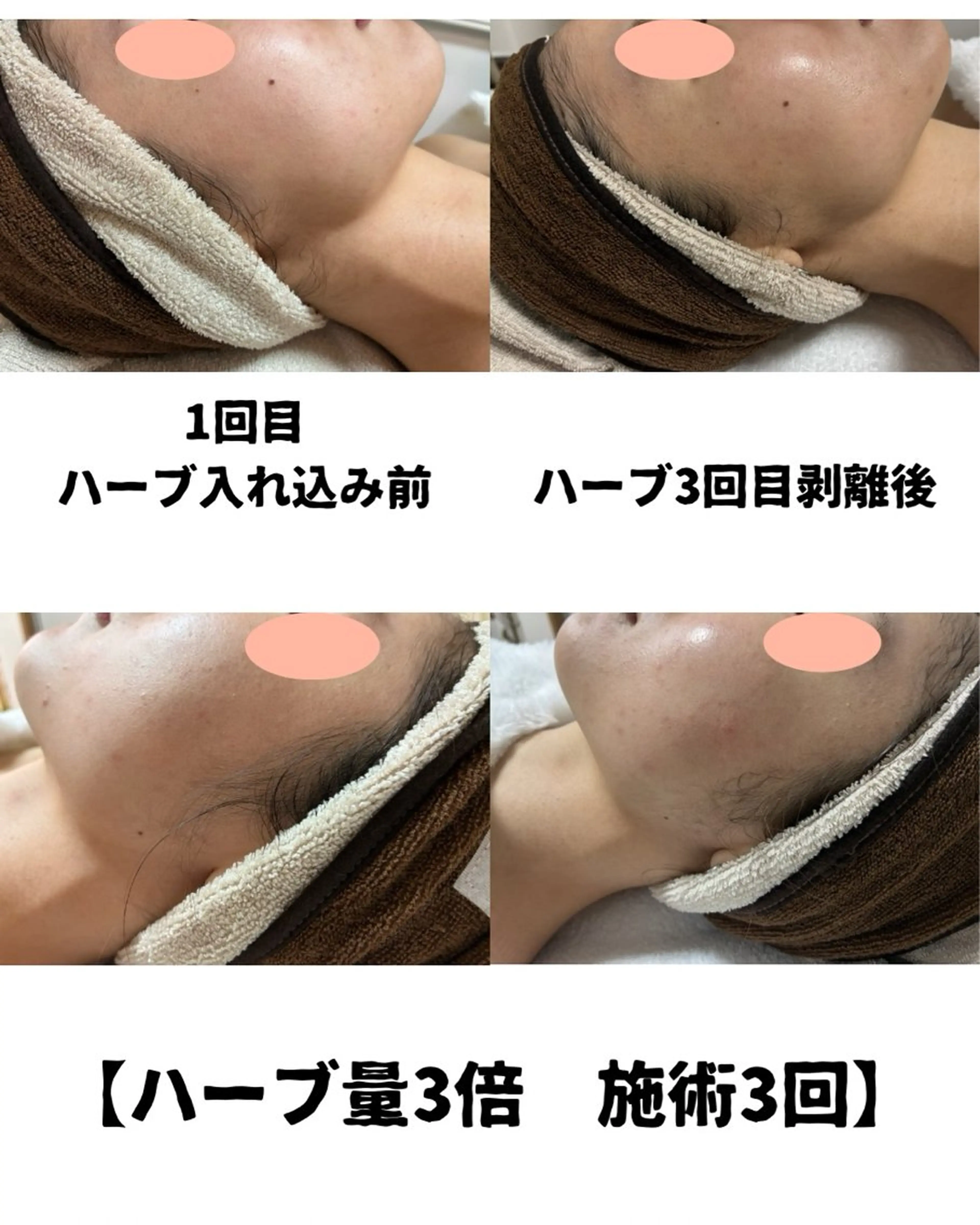 VIKI BEAUTY  クレイハーブピーリング・美肌脱毛専門店所属・VIKI BEAUTYのエステ・リラクイメージ