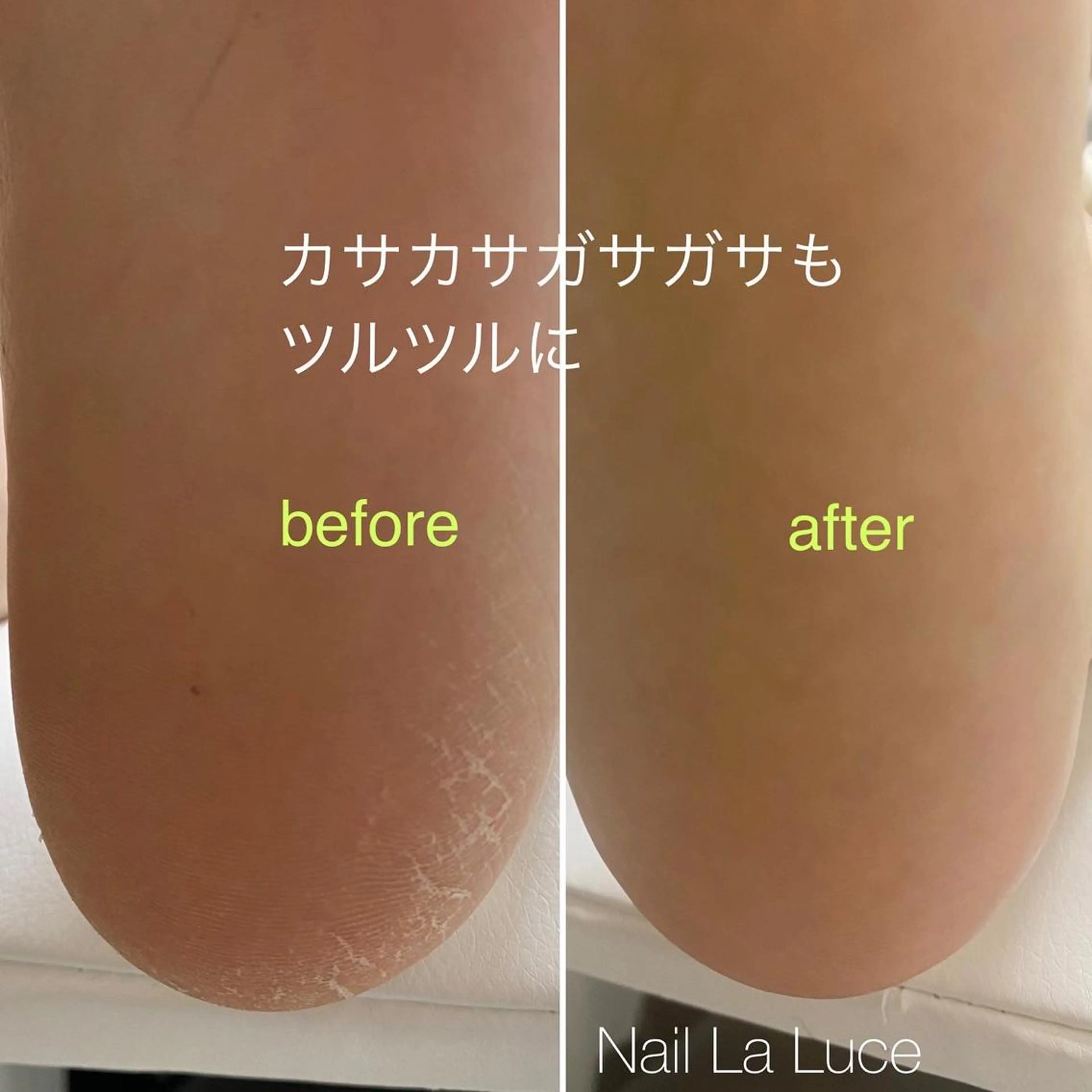 ネイル NailLaLuce ネイルラルーチェのネイルデザイン