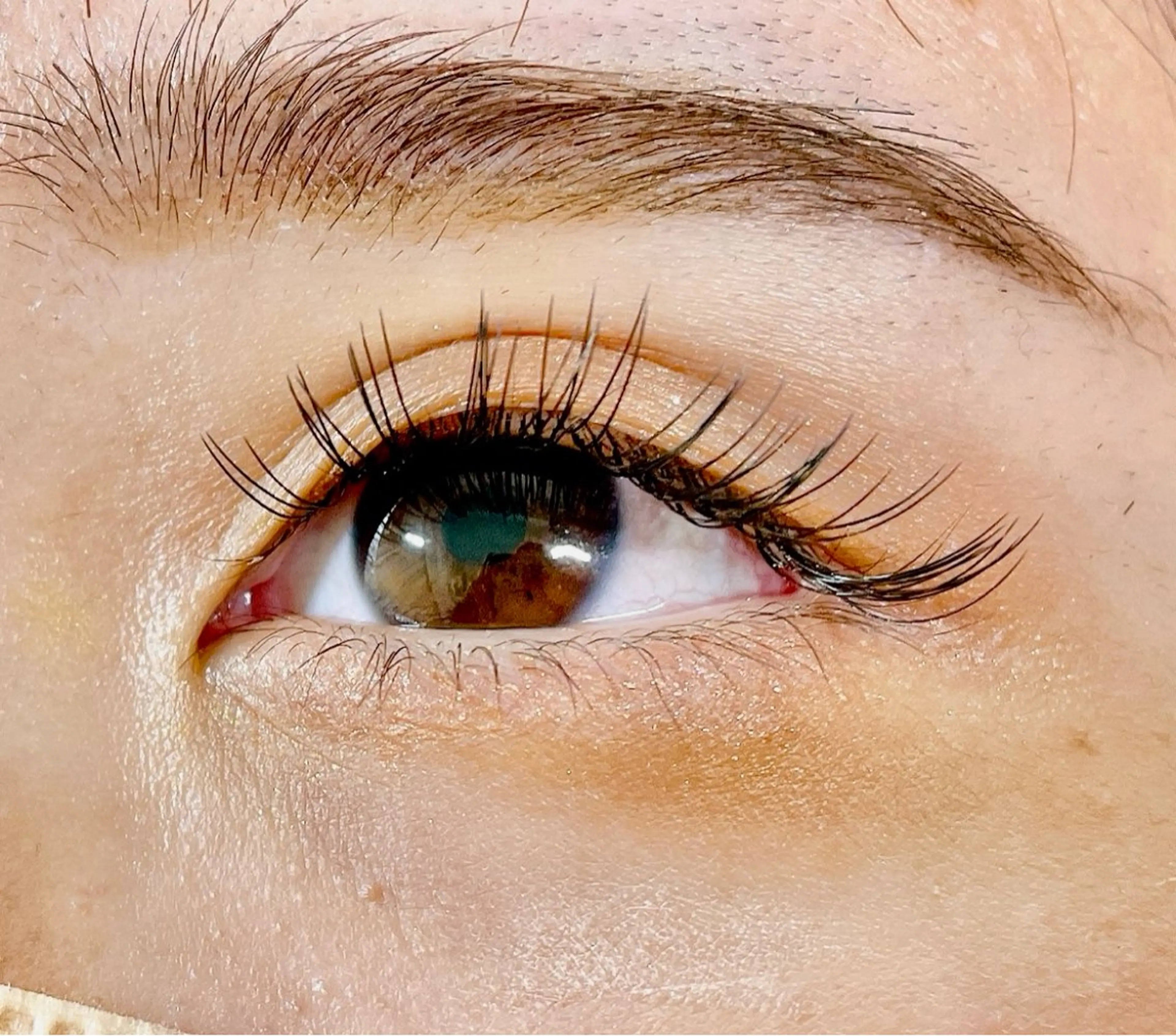 【オフなし】フラット100本の写真